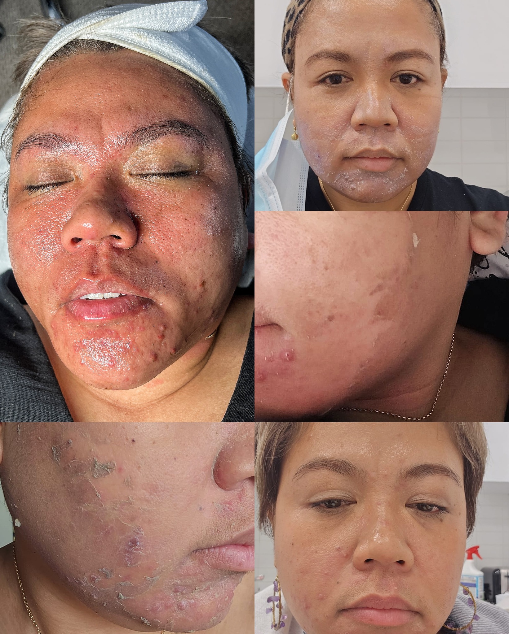 Glow Derma and Skin Facebook ad: Professional Facials & Skin Care Treatments in London…