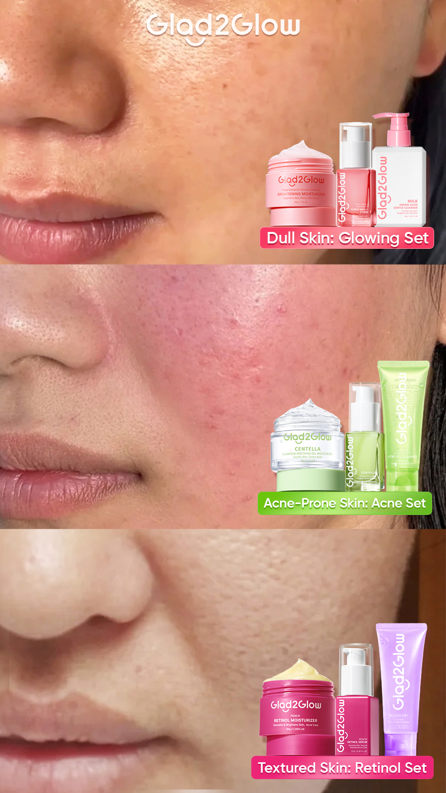 Glad2Glow Philippines Facebook ad