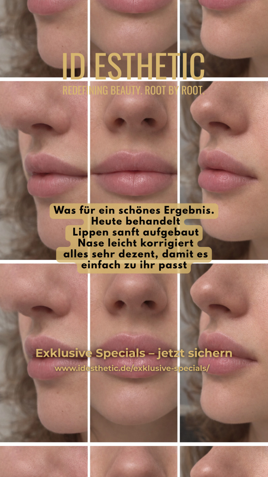 ID Esthetic Facebook ad