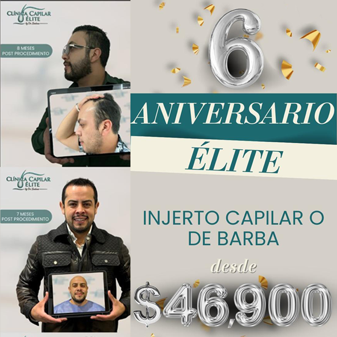 Los Reyes Del Injerto MX Facebook ad from Mar 9, 2026