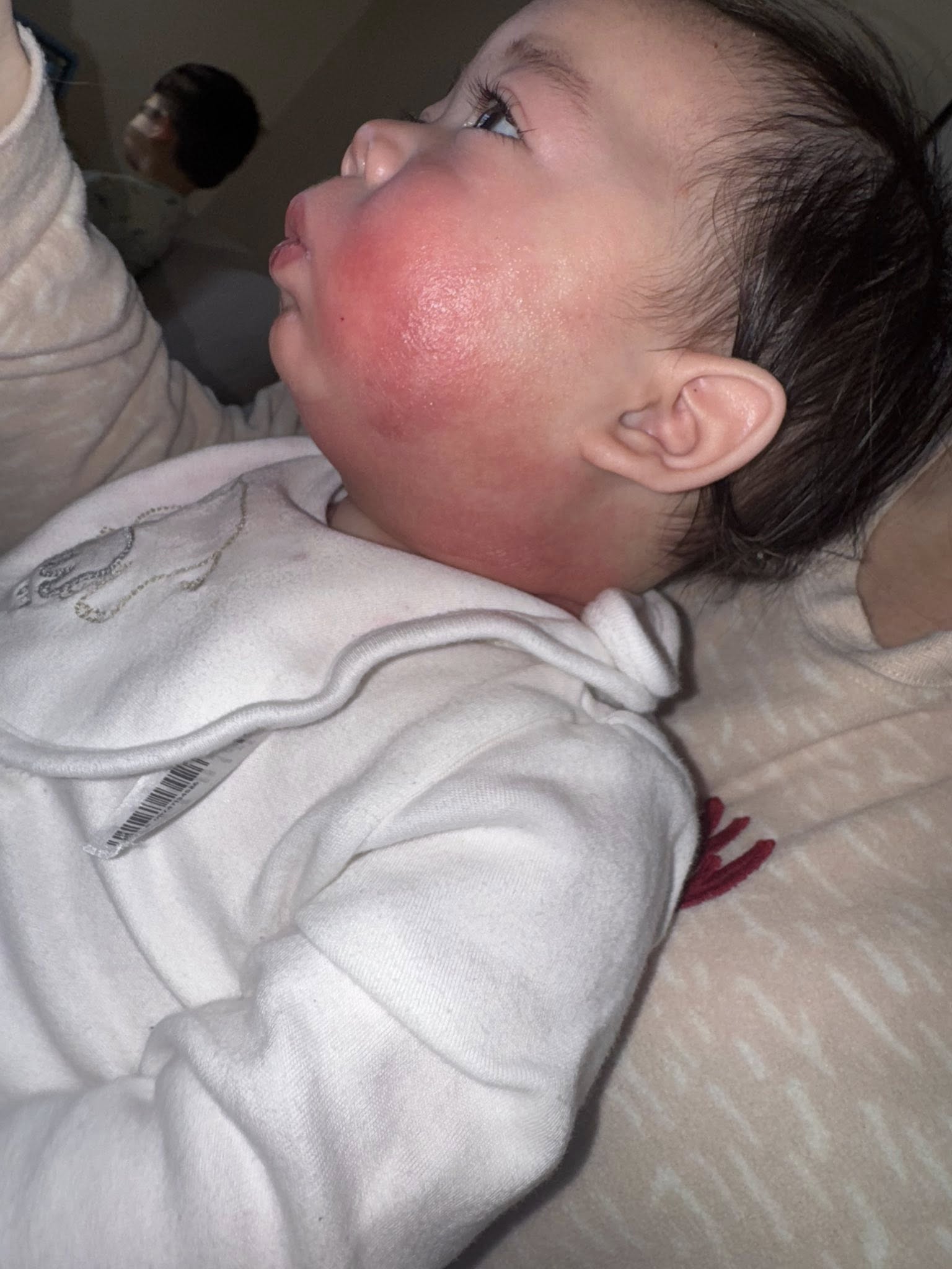 Jessica Rossi Facebook ad: Read this if your baby has eczema