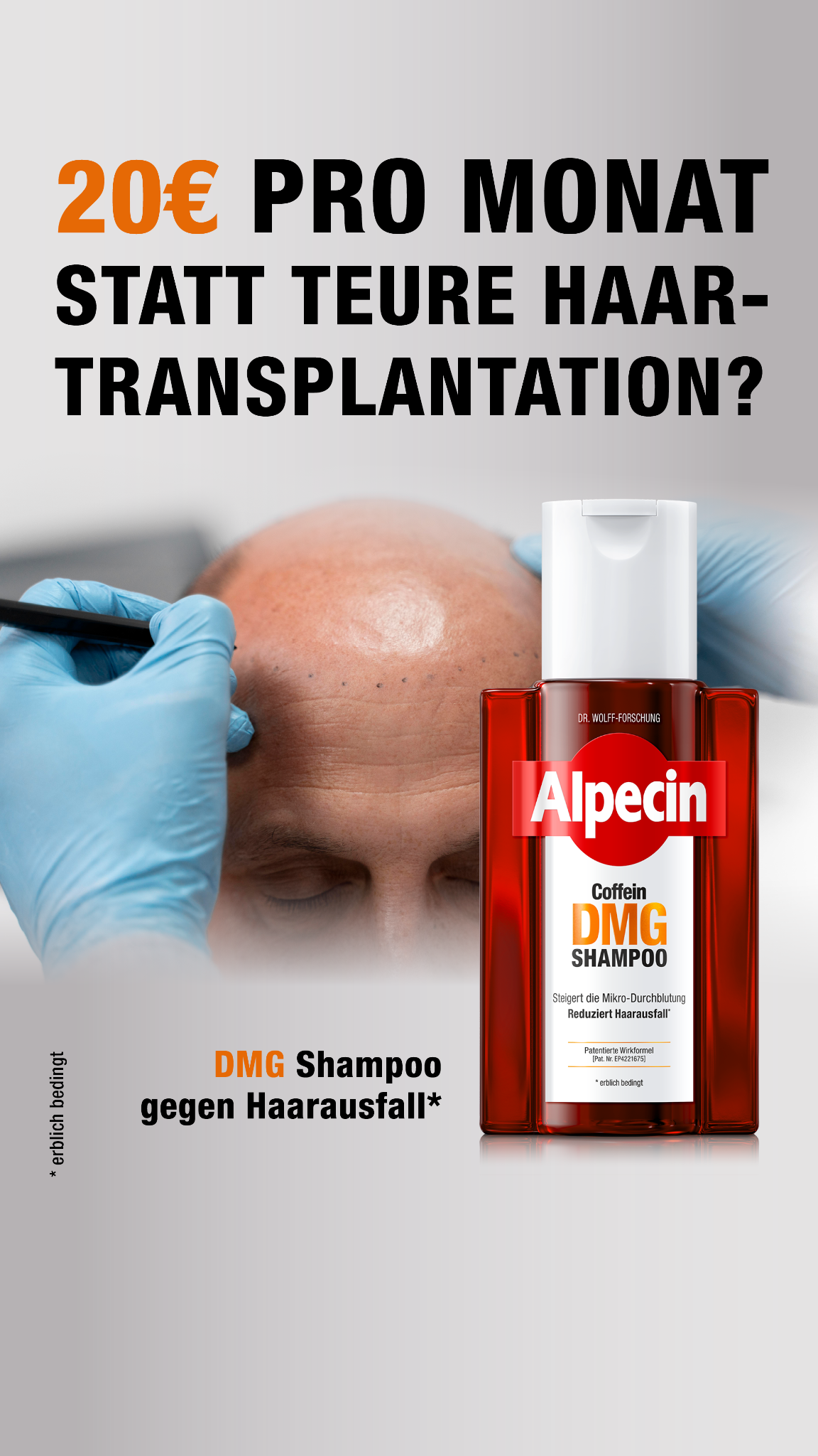 Alpecin Facebook ad