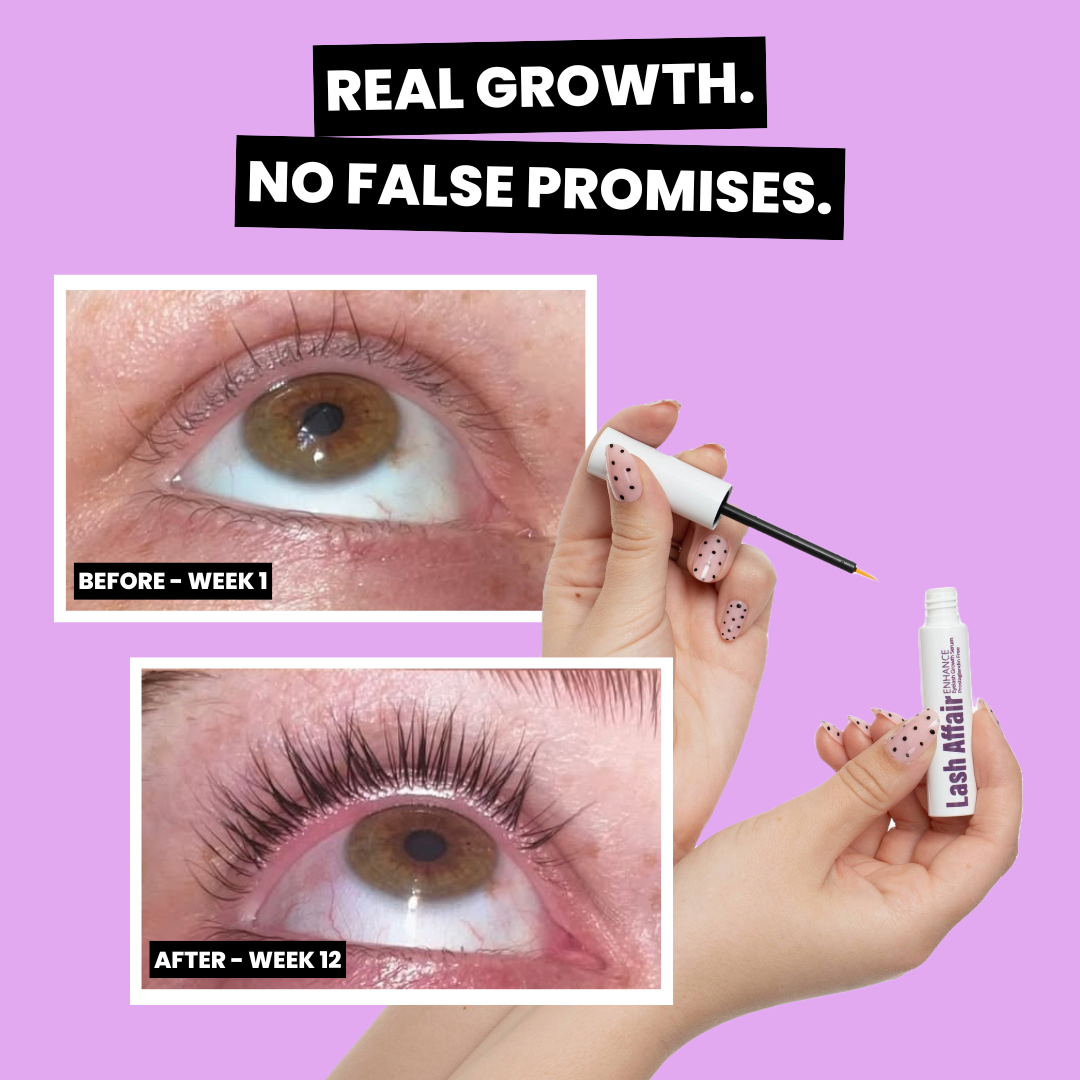 Beauty Standards NZ Facebook ad from May 17, 2026