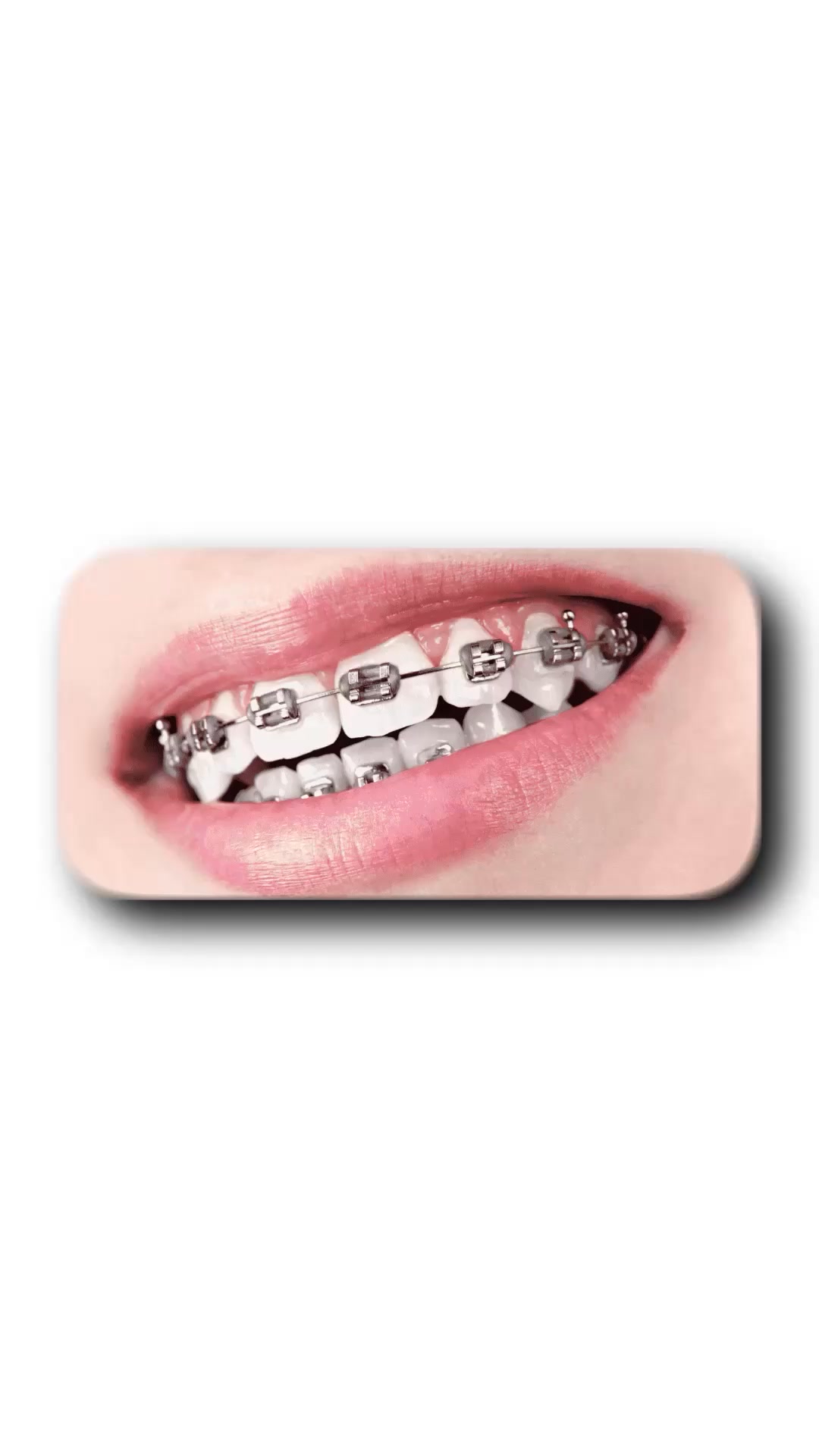 Real Dental Care ريـل لطب الاسنان Facebook ad: تقويم الاسنان بأنسب سعر وبالتقسيط المريح جداً