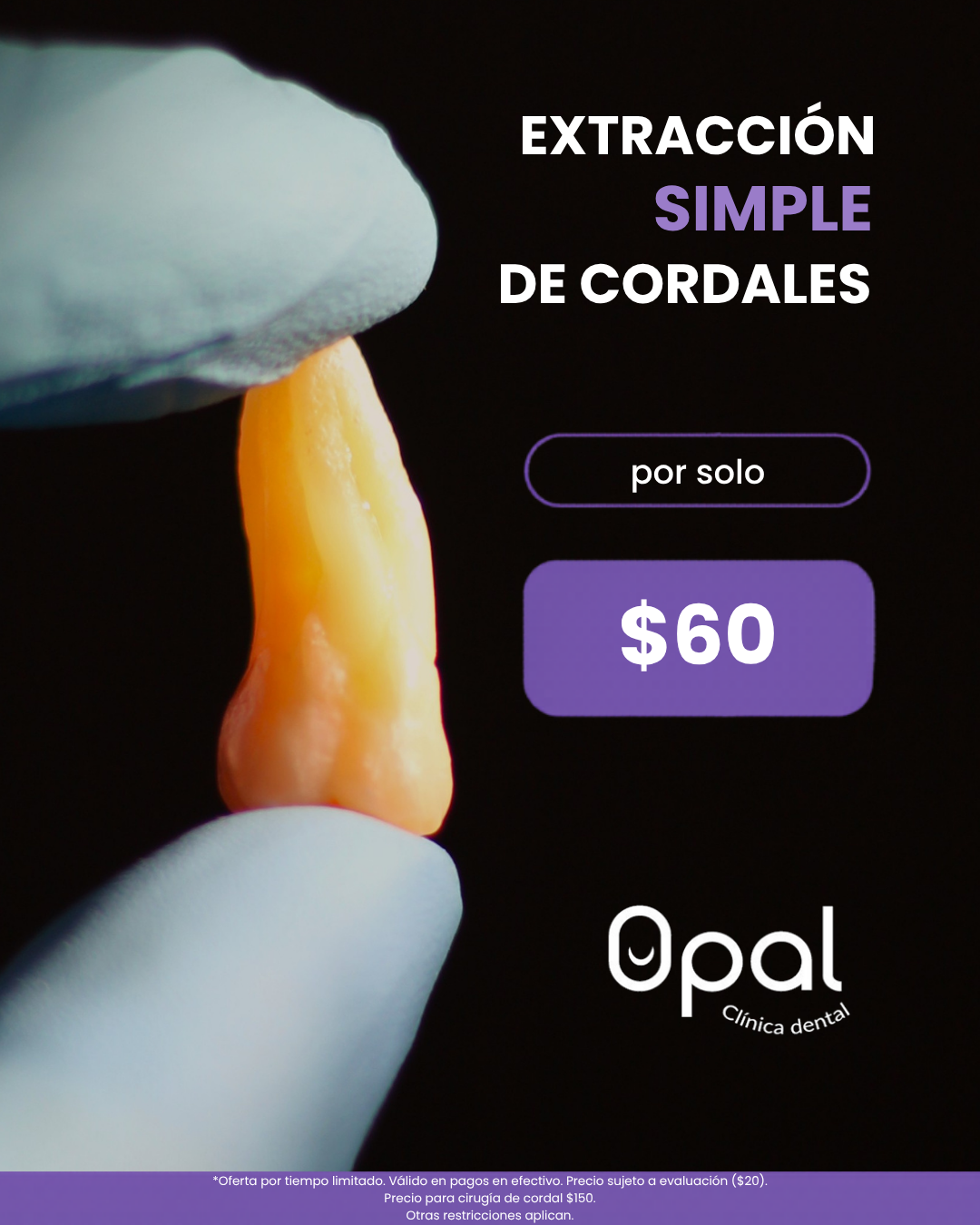Opal Clínica Dental Facebook ad