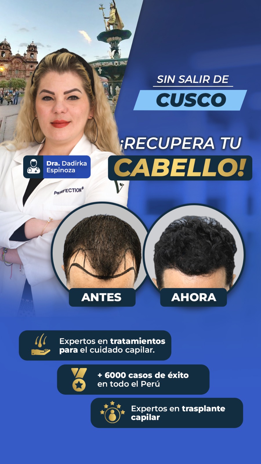 Perfection capilar - Trasplante capilar Facebook ad from Mar 1, 2026