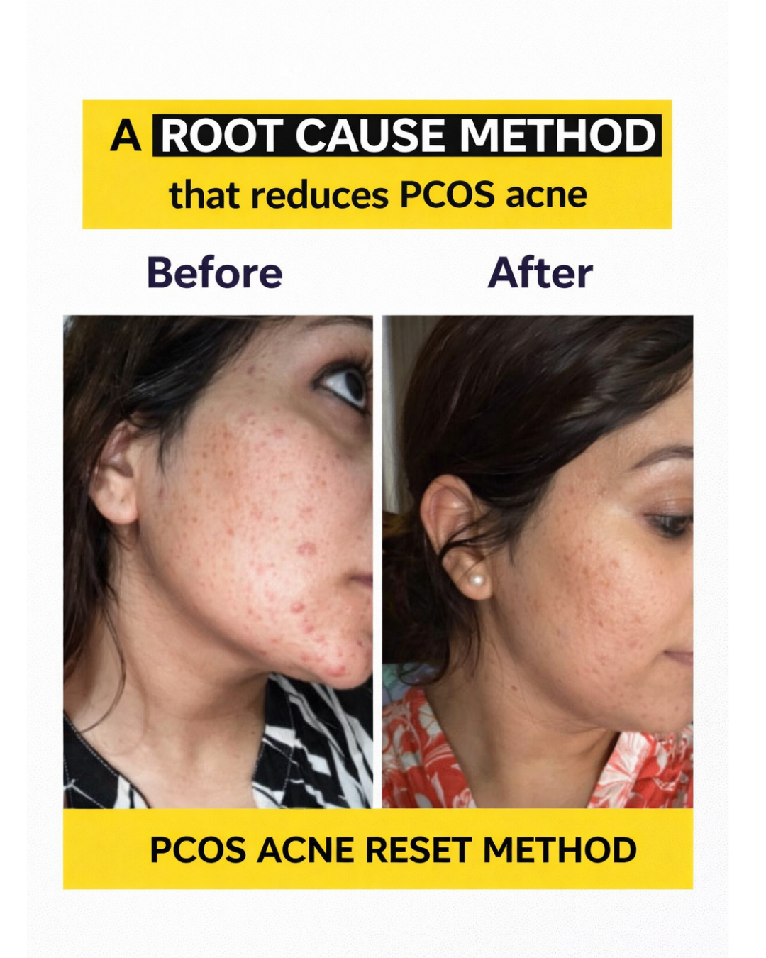 Level Up for Women Facebook ad: Working Women 26+ Reverse your PCOS in Just 6weeks!