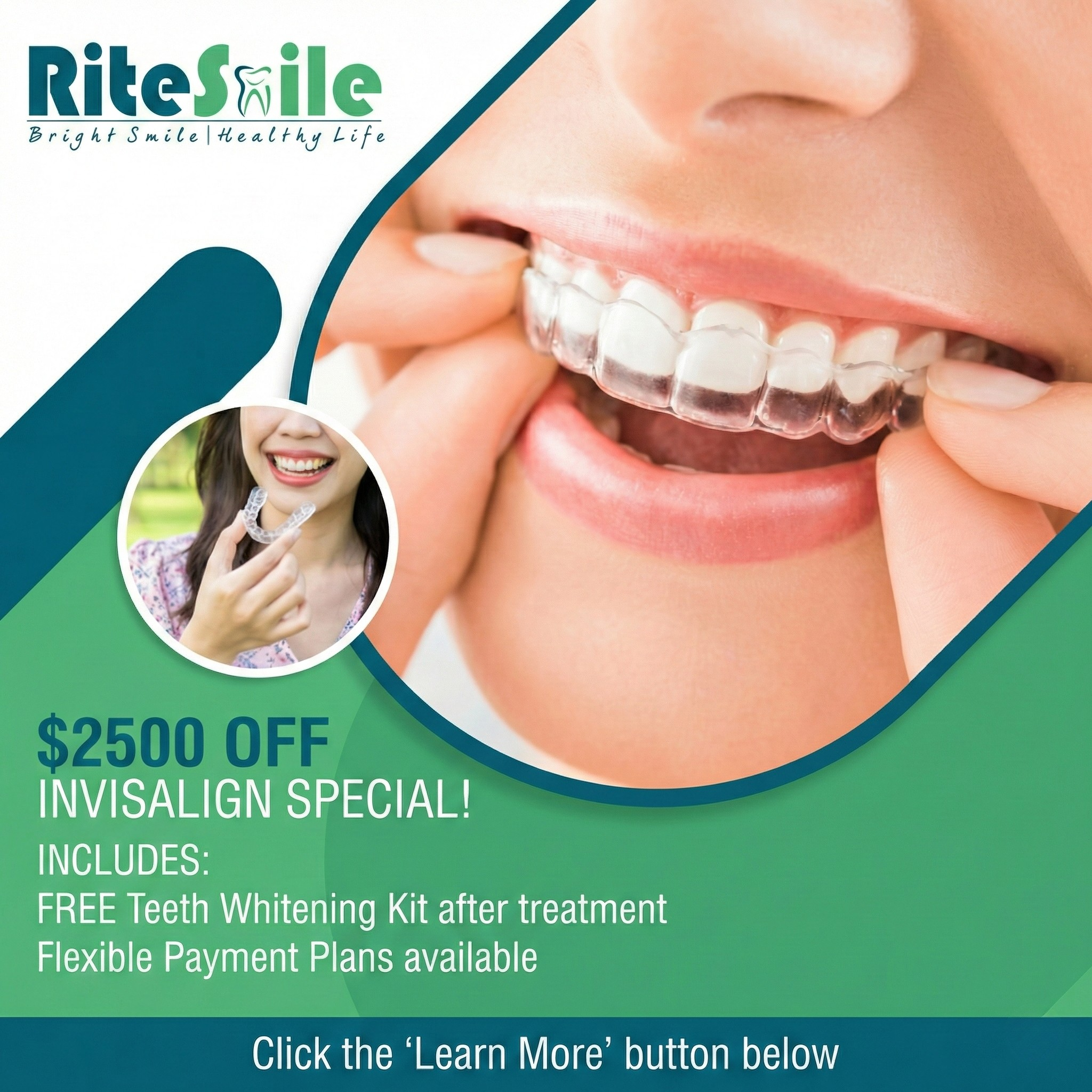 RiteSmile Dental Facebook ad: New Jersey Special: $2,500 OFF Invisalign + FREE Teeth…