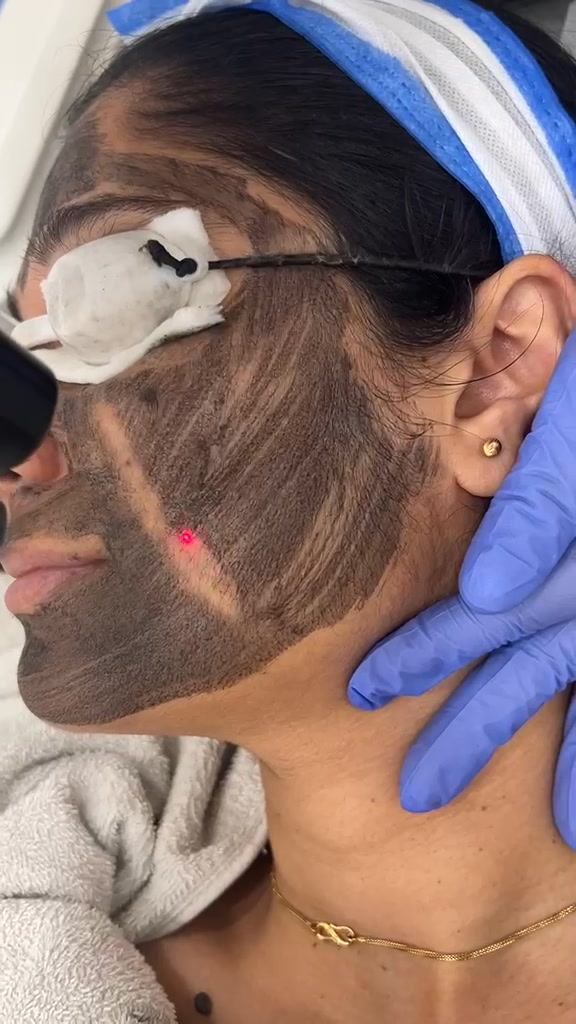 SKIHT Facebook ad: SKIHT - Dehradun's #1 Skin & Hair Transplant Clinic…
