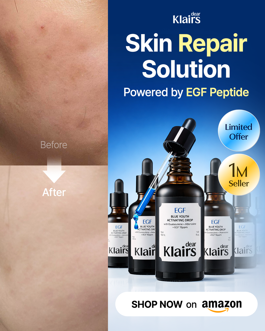 Klairs US Facebook ad from Jun 10, 2026