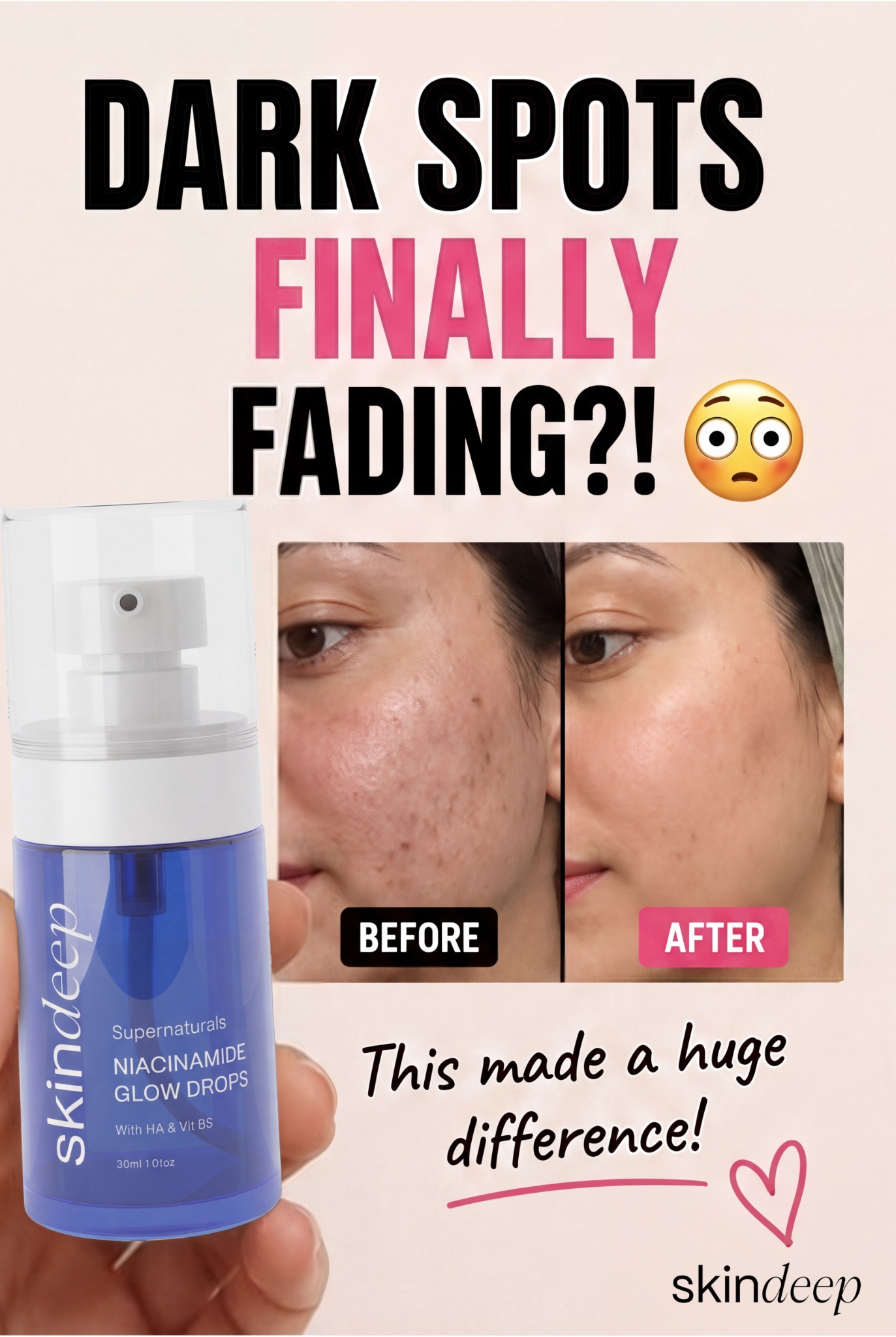 Skin Deep Facebook ad