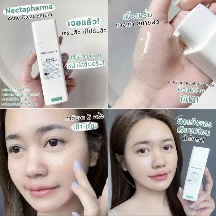 ลุ๊คขิม รีวิว Facebook ad: ดูแลผิวเป็นสิวอย่างอ่อนโยน