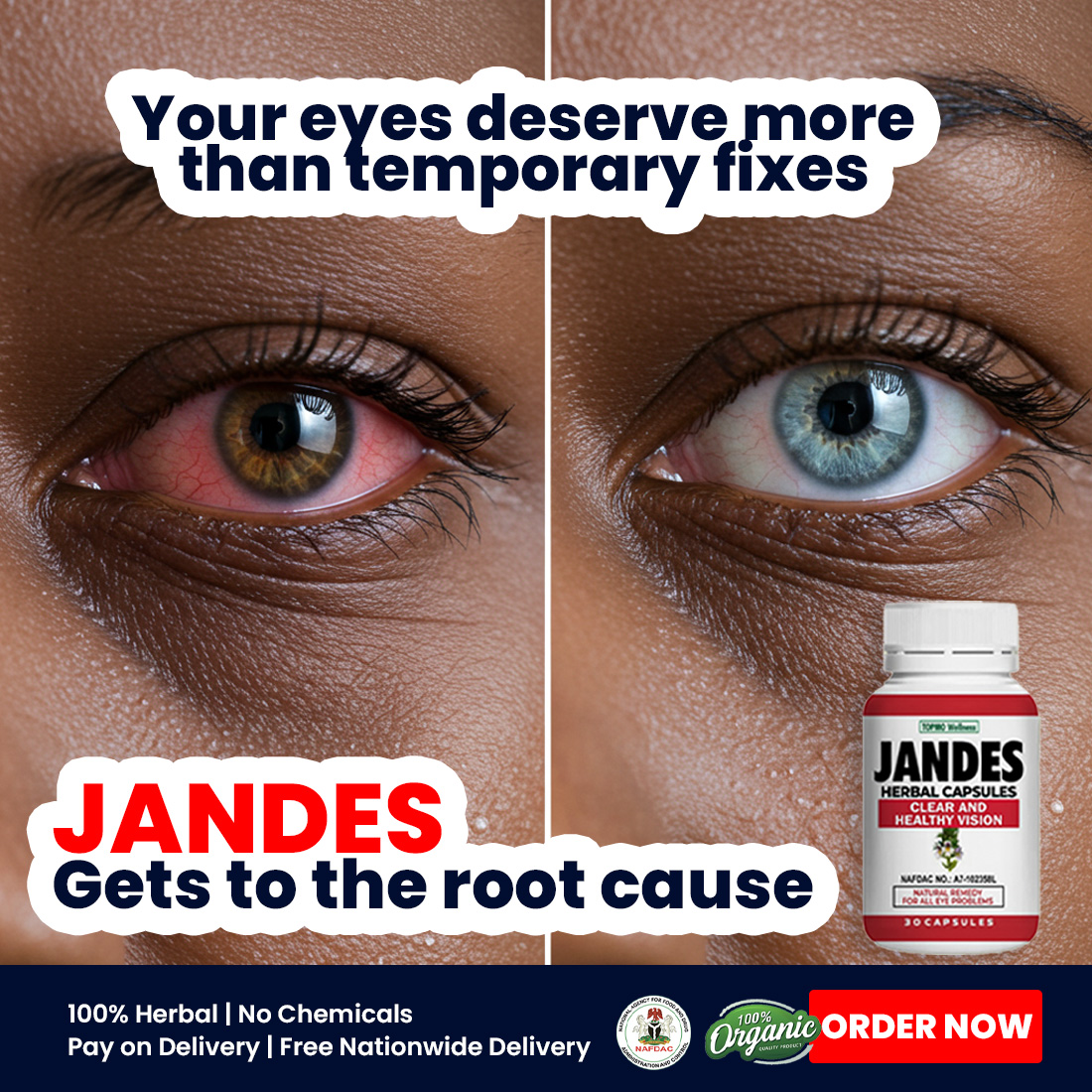 Herbal Solution Facebook ad: Thousands are already free from eye pain, cataracts…