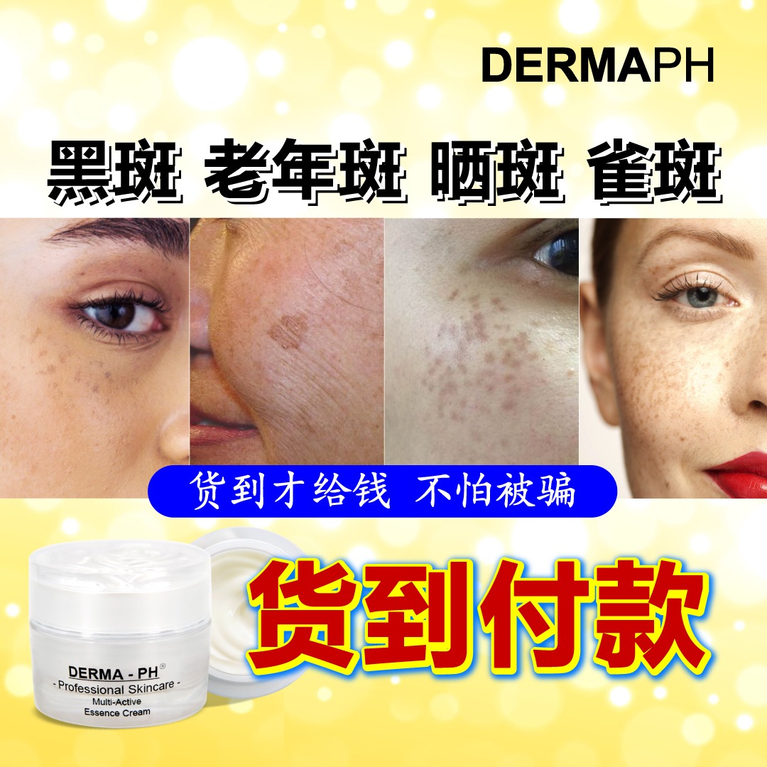 Dermaph祛斑那件事【011-2570 0628 瑶瑶 】 Facebook ad: 新年最新优惠 有买有送 只限59位,点击>>>