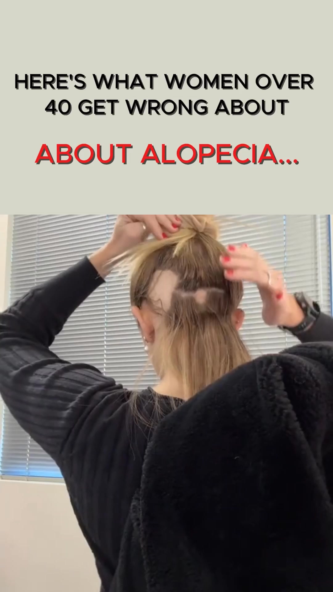 Sincerely JoJo Facebook ad: Reverse Hair Loss Safely