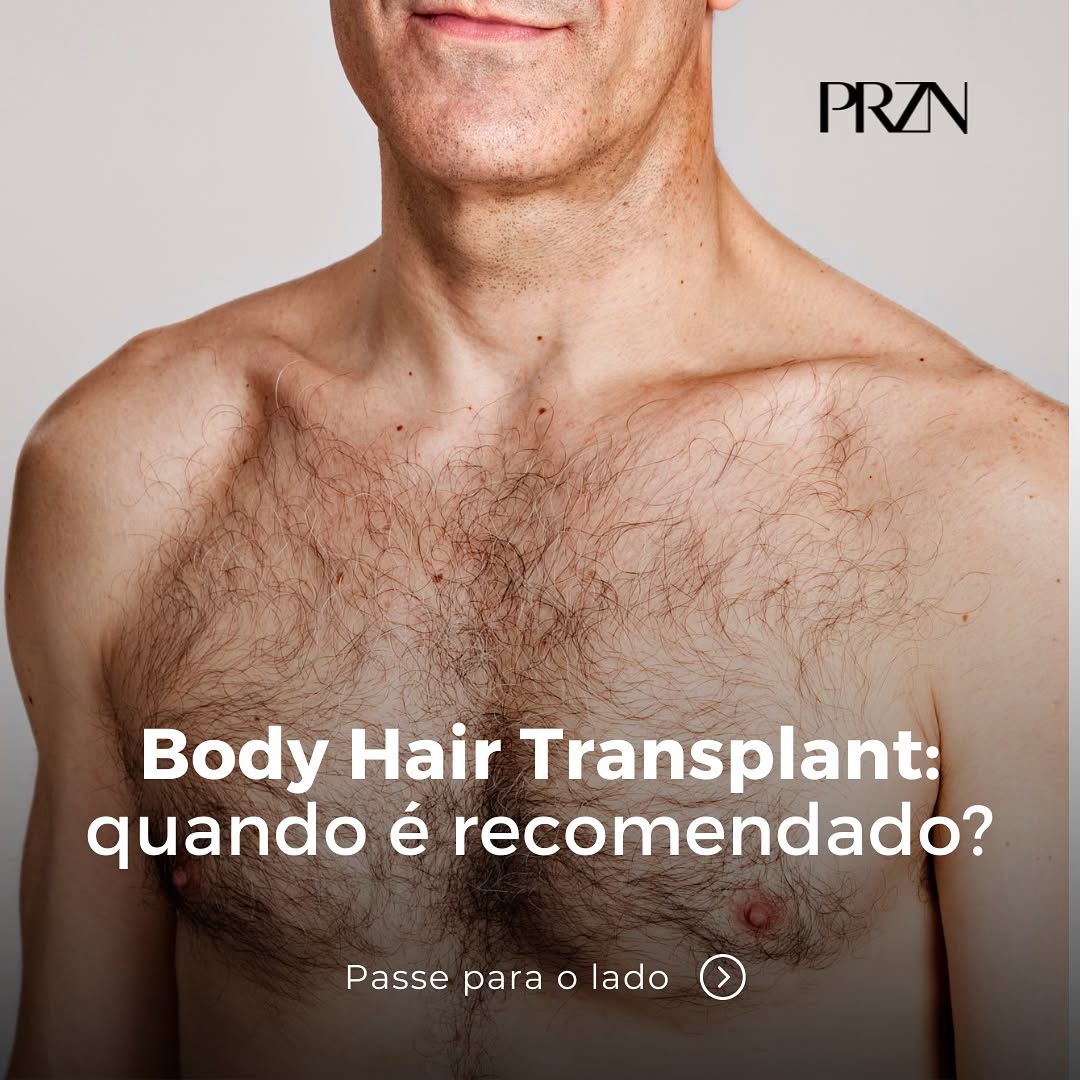 Clínica Pierezan - Tratamento Capilar Facebook ad: Aqui na Pierezan, um dos nossos grandes diferenciais…