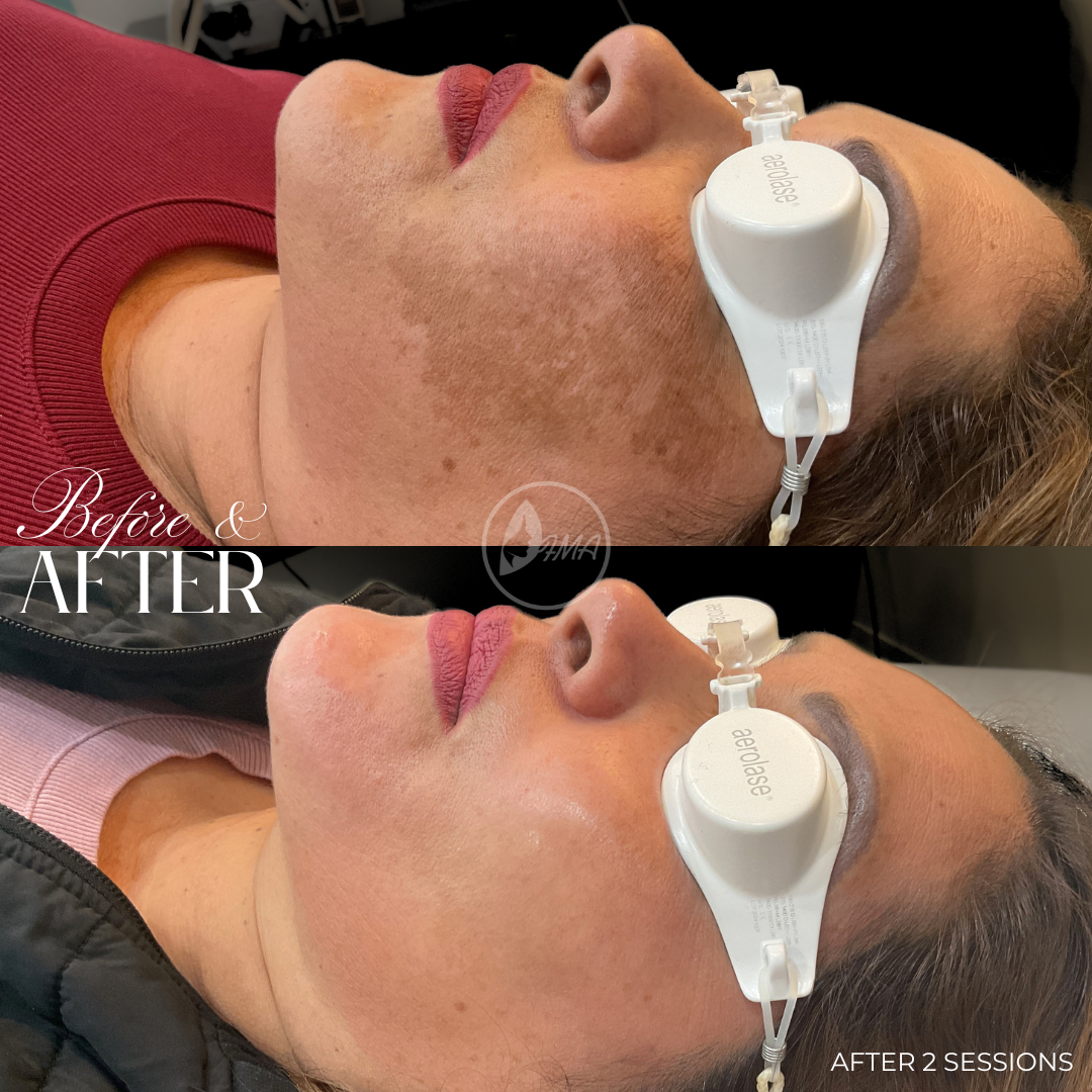 Fyxson Medical Aesthetics Facebook ad: Chat with us