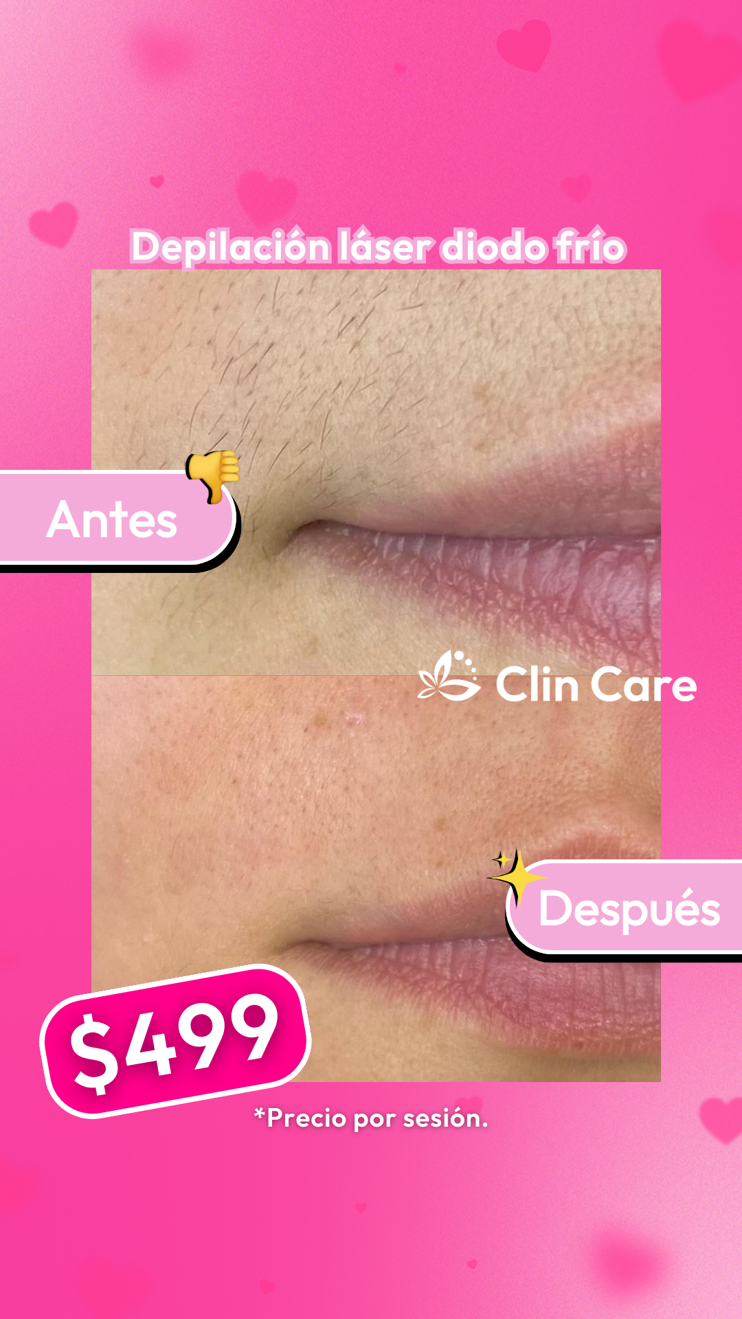 Clin Care - Depilacion laser & Med Spa Facebook ad from Jan 29, 2026