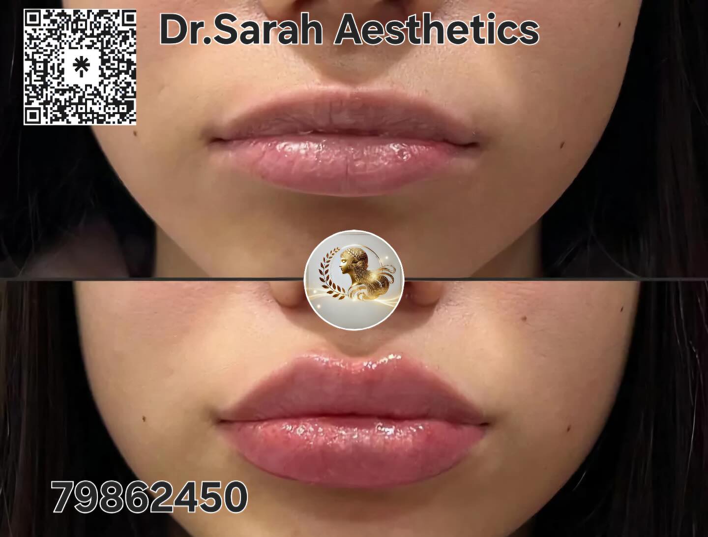 Dr.Sarah Aesthetics Facebook ad: Perfect, Plump, and Natural-Looking Lips!