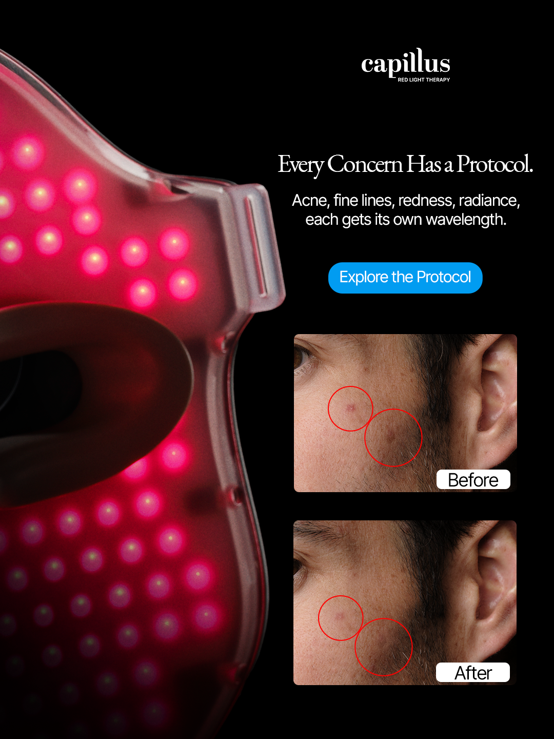 Capillus Facebook ad
