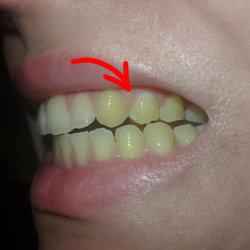 Dr. Amy Stanway Facebook ad: Whiter Teeth Now