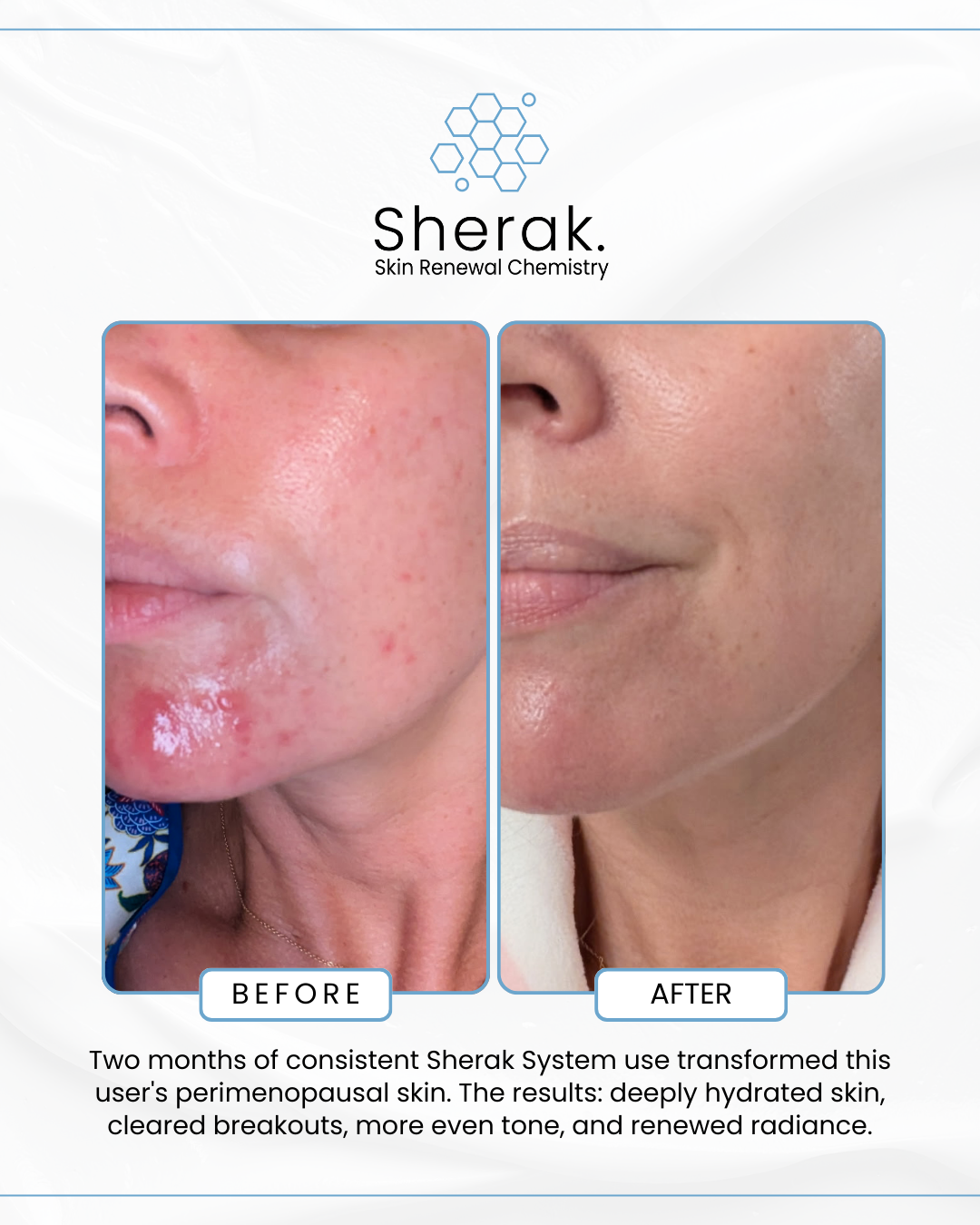Sherak Skin Facebook ad from Apr 2, 2026