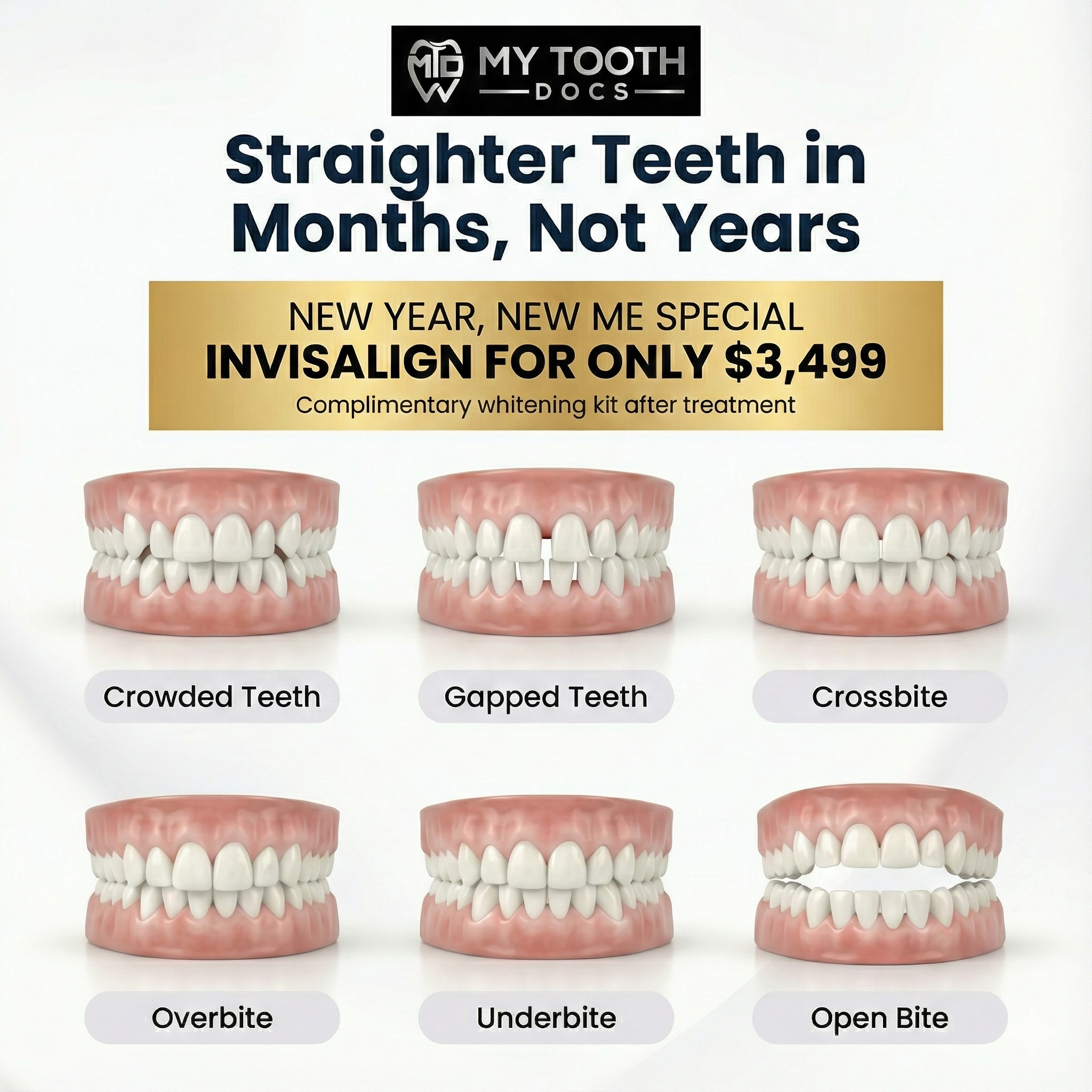 My Tooth Docs Facebook ad: Exclusive Naperville Deal: $3499 Invisalign treatment +…