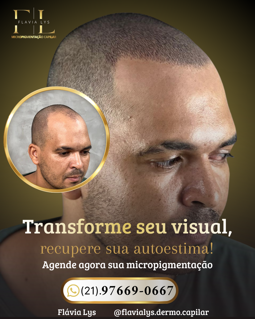 Flavia Lys Micropigmentaçao Facebook ad