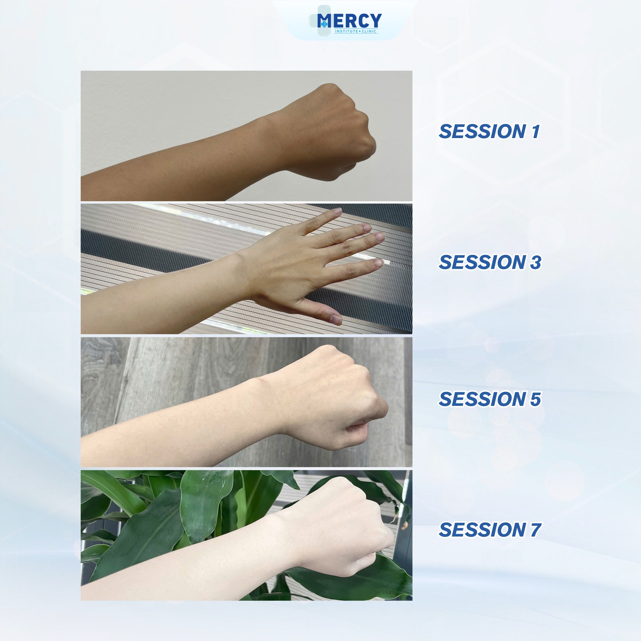 Mercy Aesthetic Clinic Facebook ad