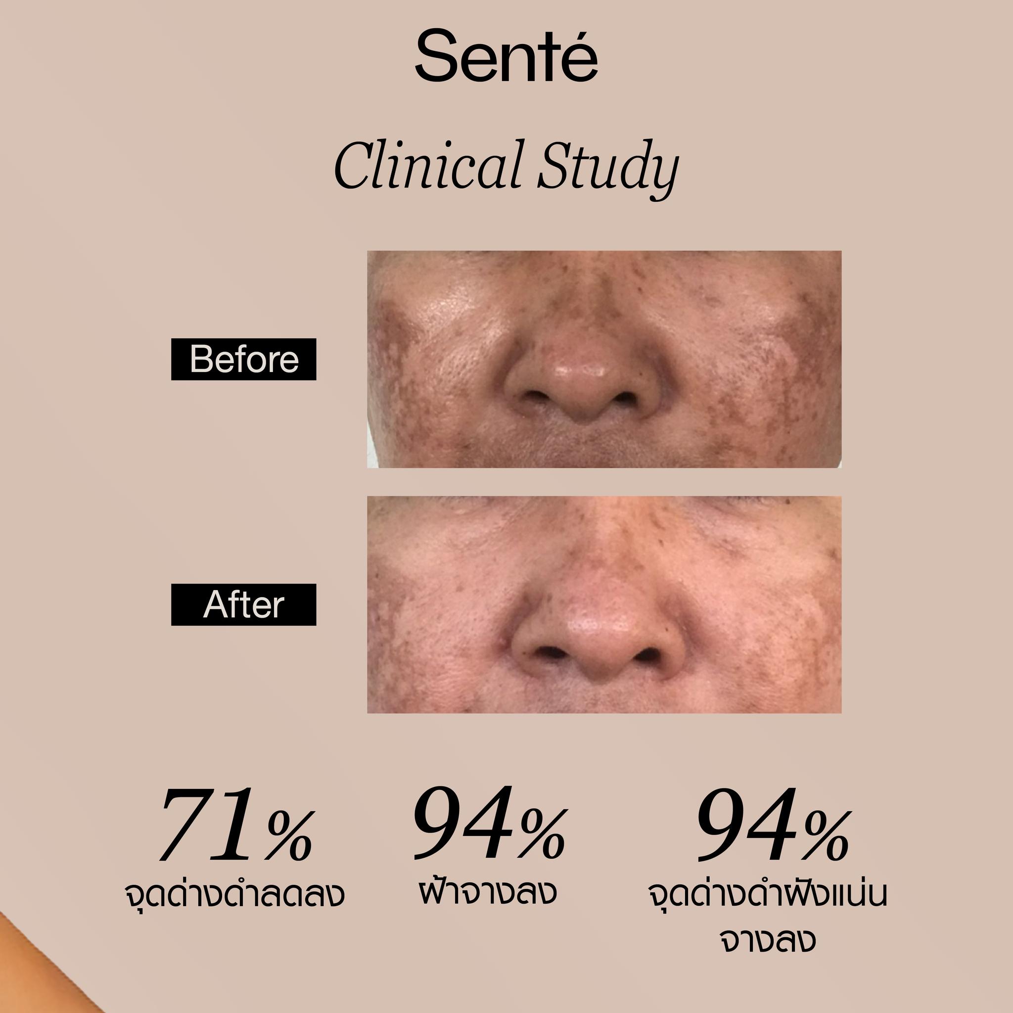 Sente Thailand Facebook ad: Sente ผลิตภัณฑ์ Medical Grade Skincare จากอเมริกา