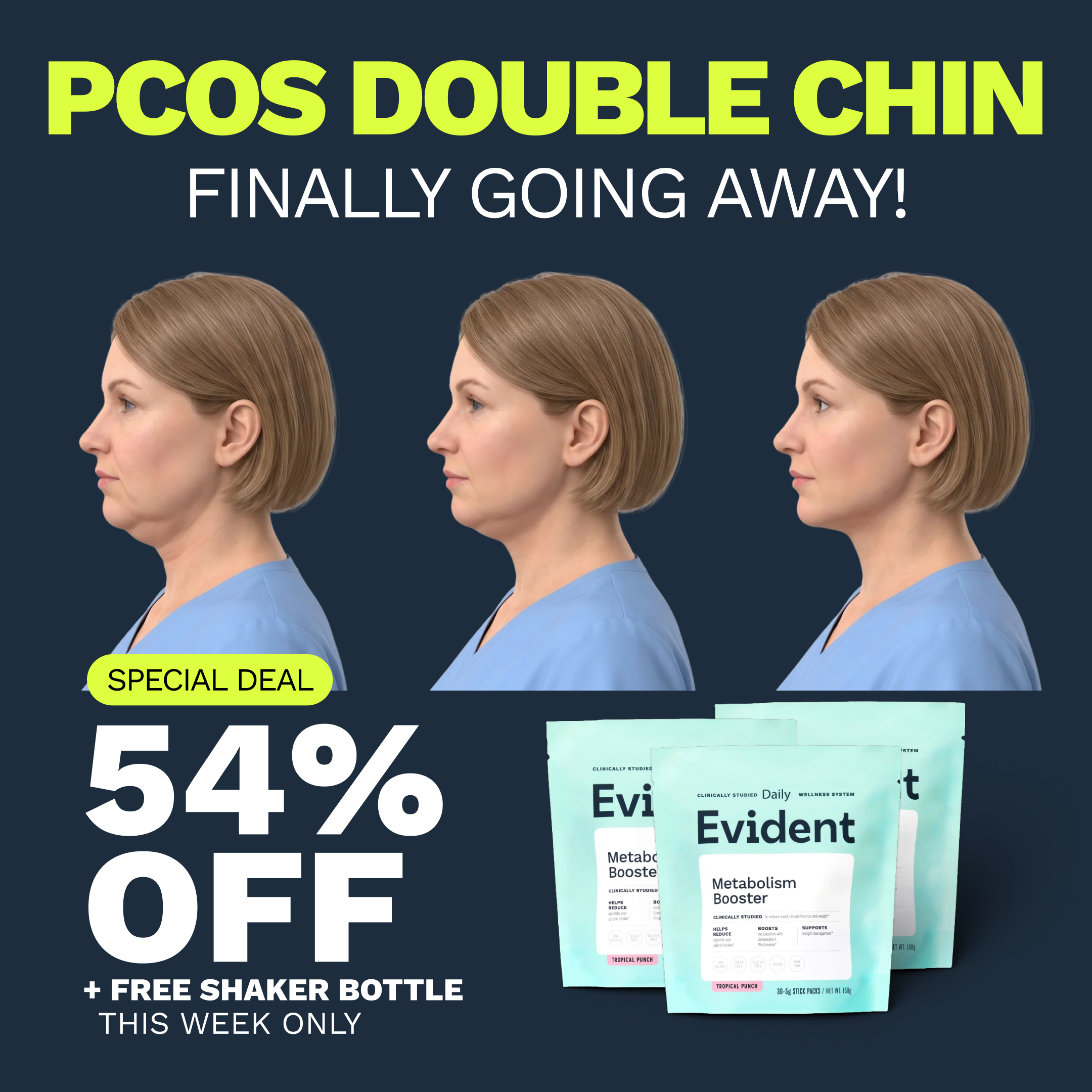 My Life with PCOS Facebook ad