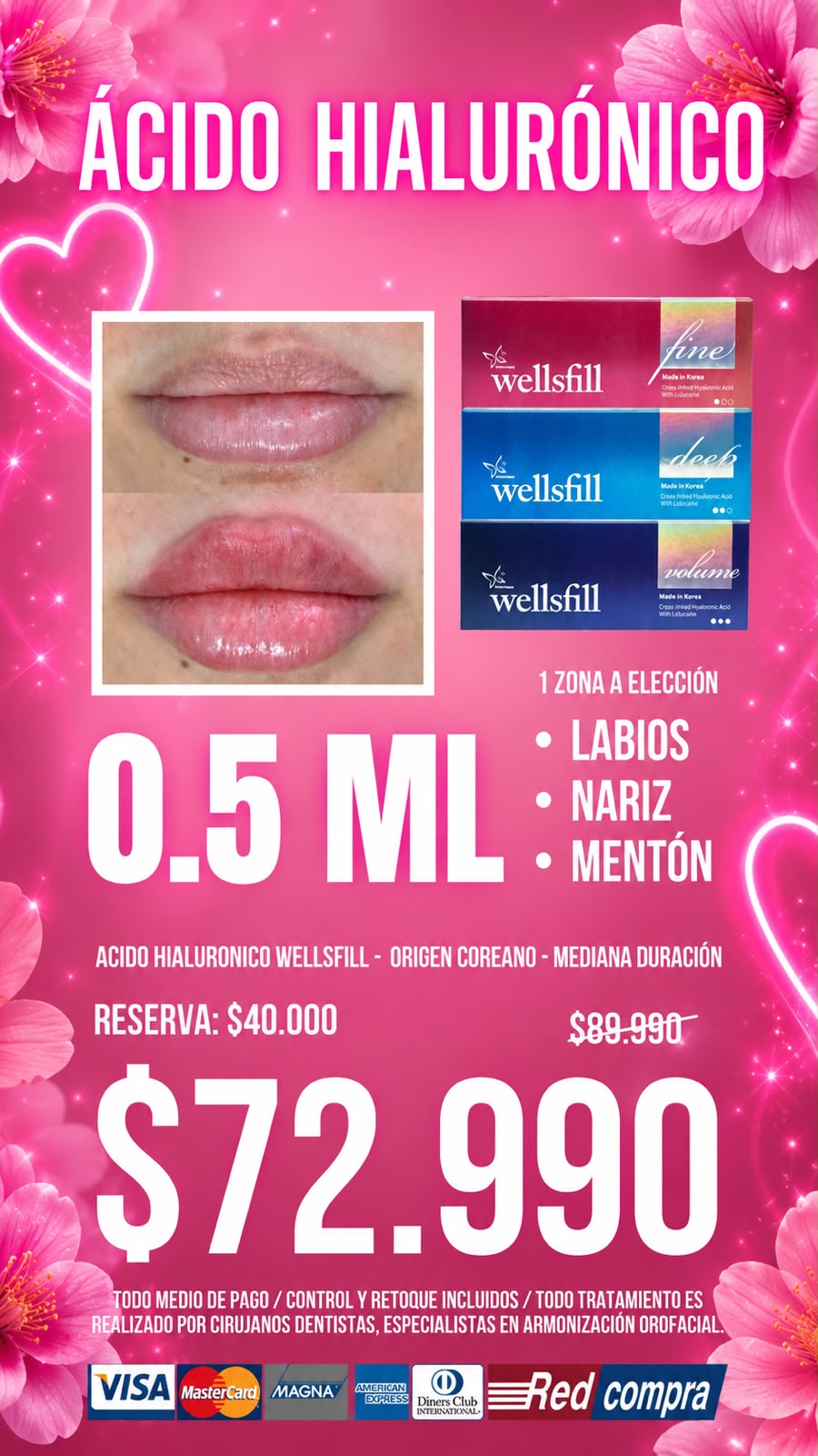 Clínica Estheticskonst Facebook ad: Wellsfill 0.5ml, $72.990
