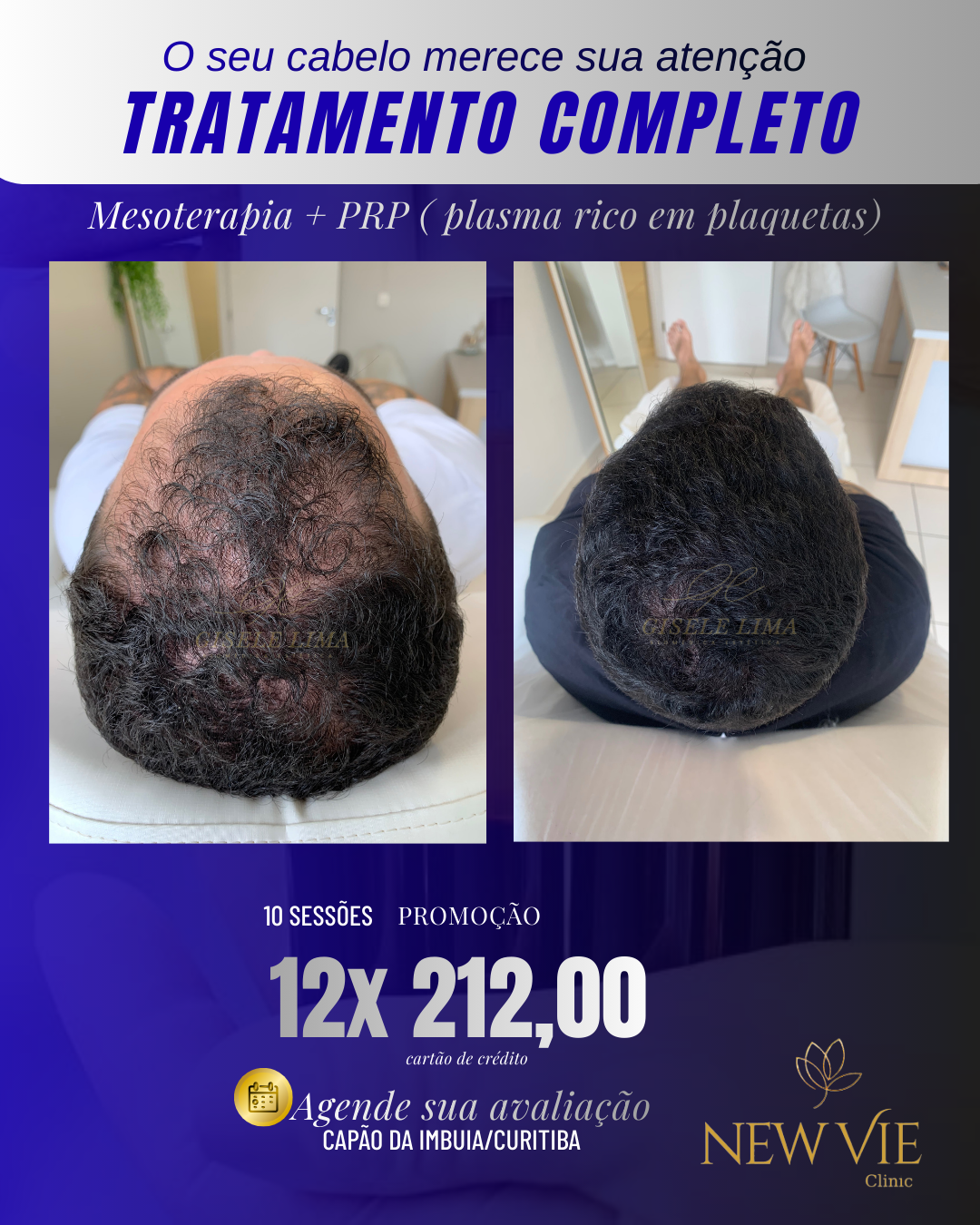 NewVie Clinic Facebook ad