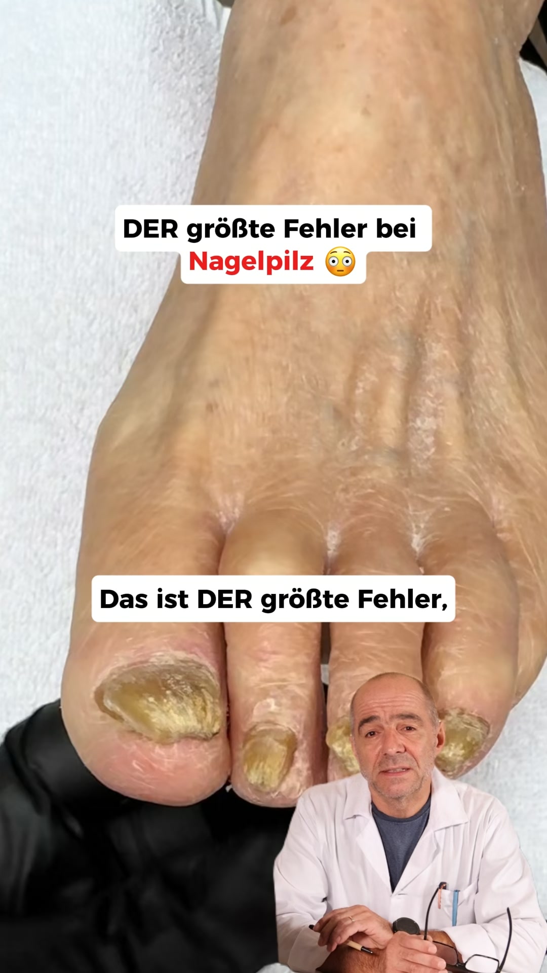Nagelpilz Ratgeber Facebook ad: Der größte Fehler bei Nagelpilz