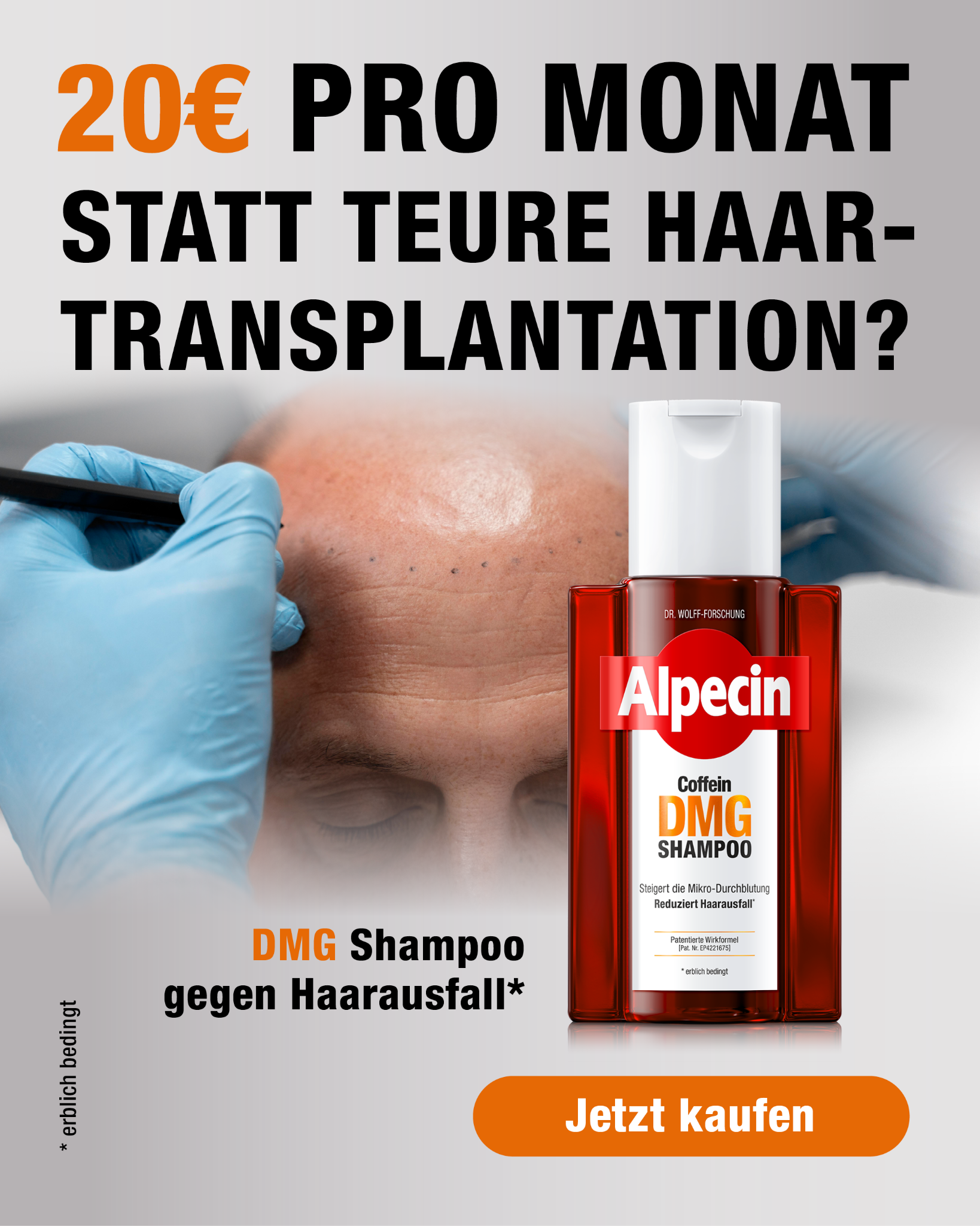 Alpecin Facebook ad