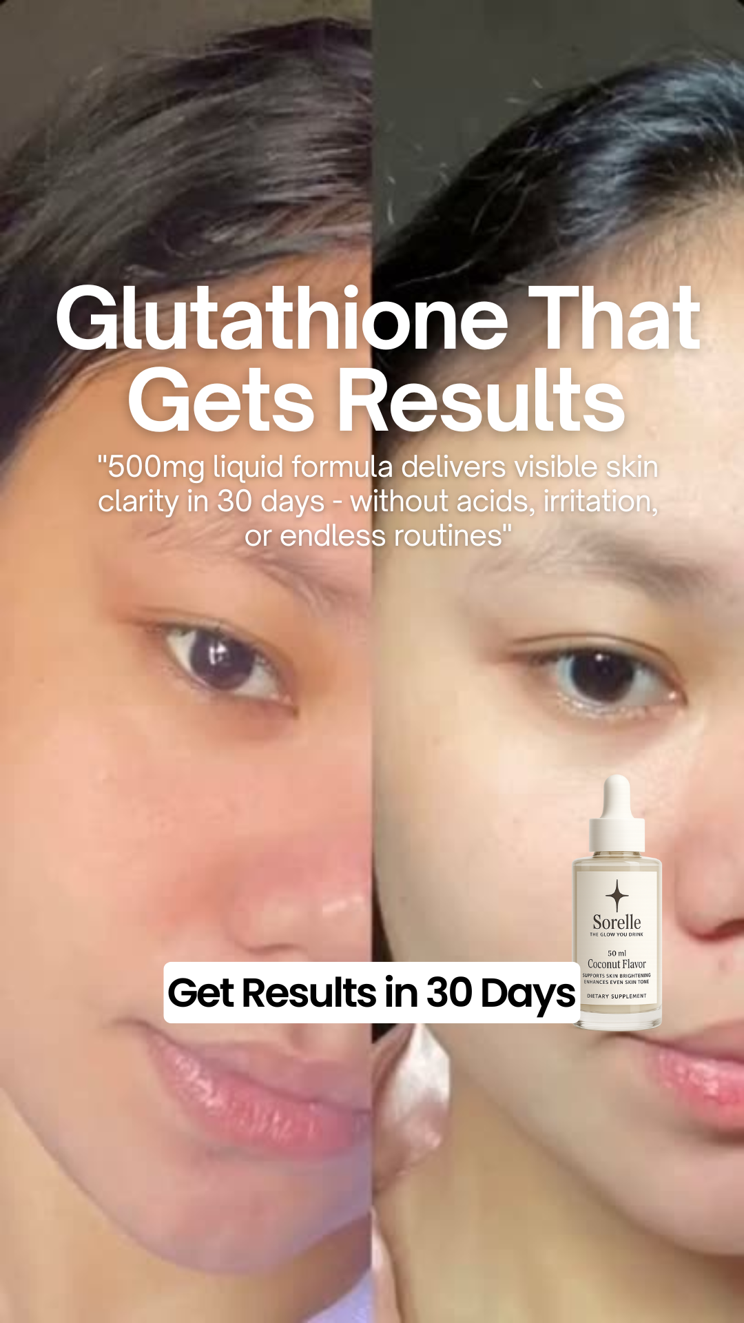 Sorelle Brightening Facebook ad: Glutathione-Powered Skin Whitening