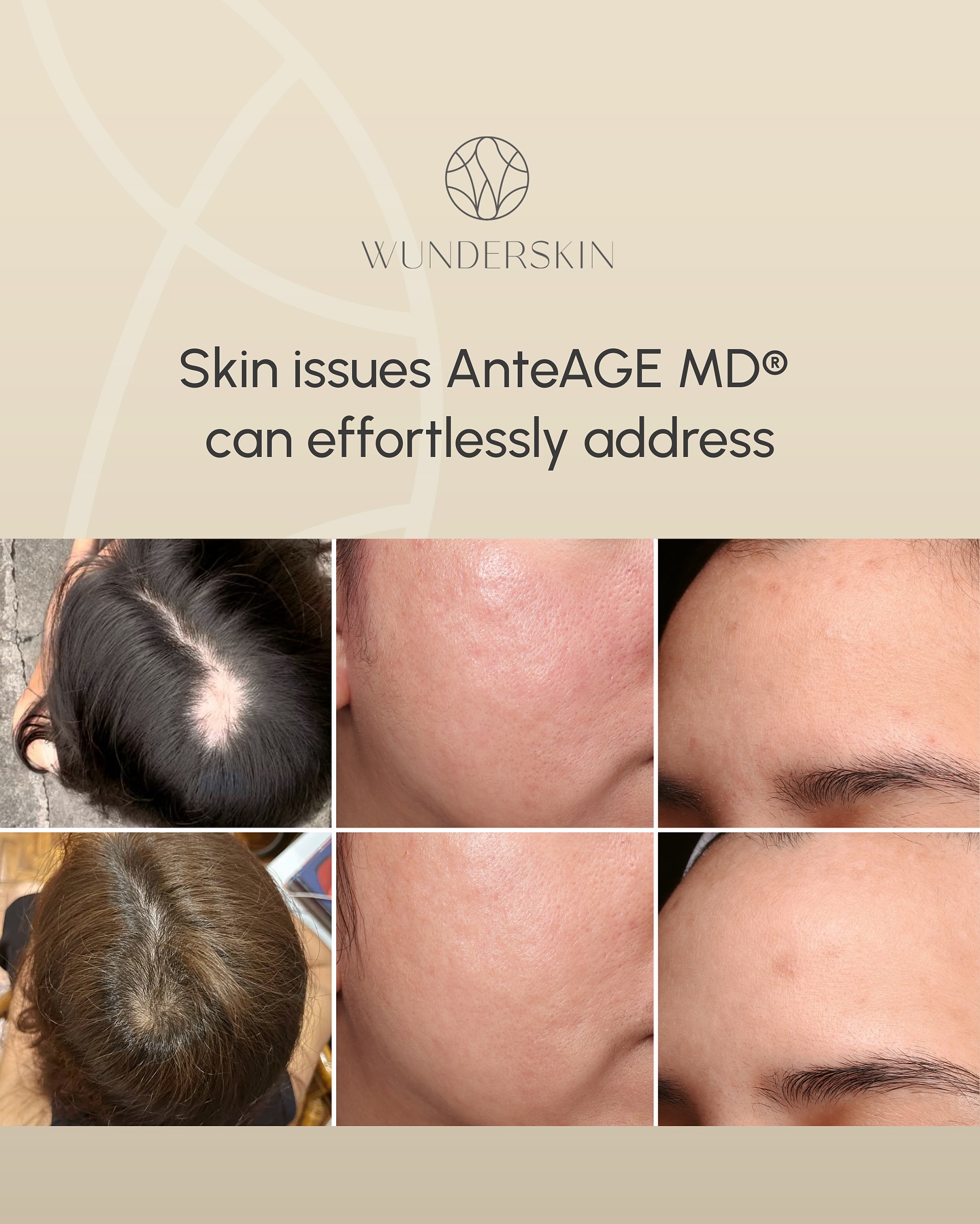 Wunderskin Facebook ad: Skin doesn’t struggle for just one reason.
