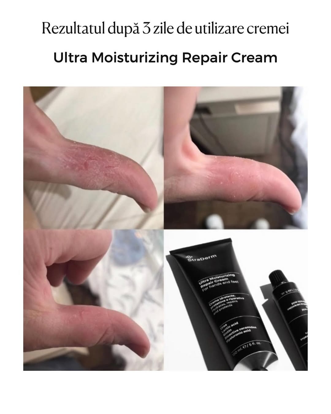 straderm.ro Facebook ad: StraDerm pentru îngrijirea personală