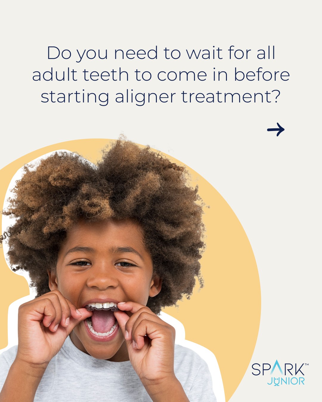 Spark Aligners Europe Facebook ad: Clear aligners can do more than straighten teeth.