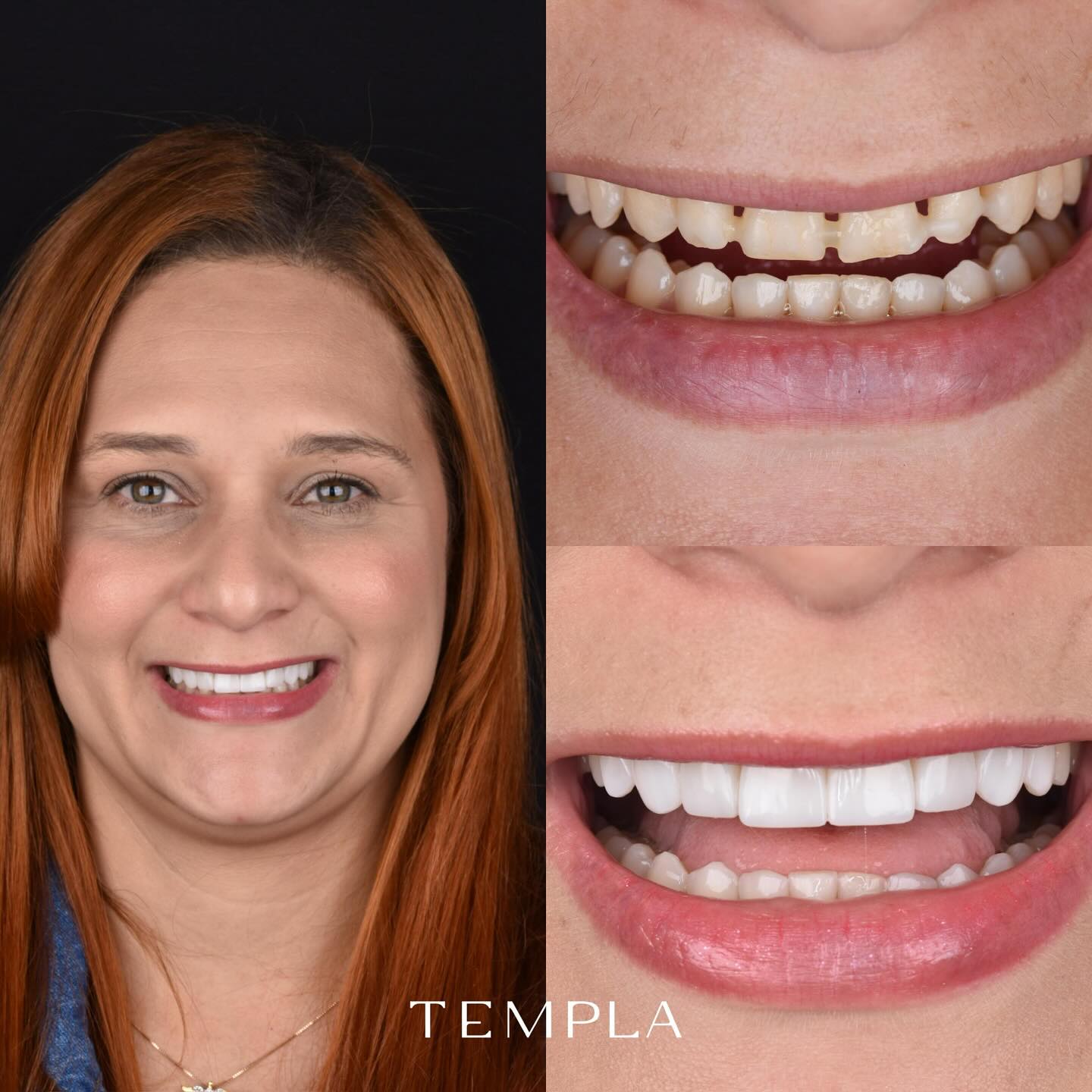 Templa Odontologia Facebook ad: Ela chegou até nós em silêncio um sorriso…