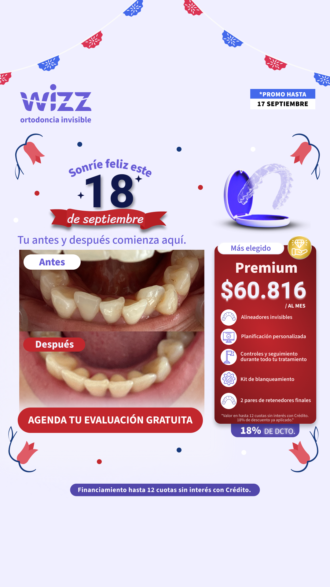 Wizz Chile Facebook ad: Alineadores en cuotas | 6 cuotas *Sin tarjeta de crédito*