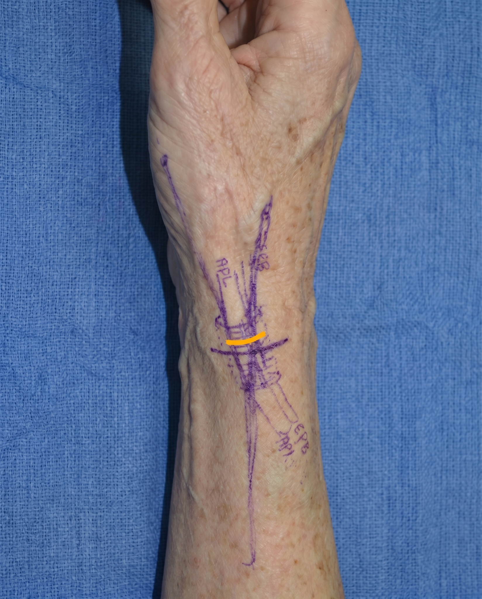 Dr Simmons, Hand Therapist Facebook ad from May 24, 2026