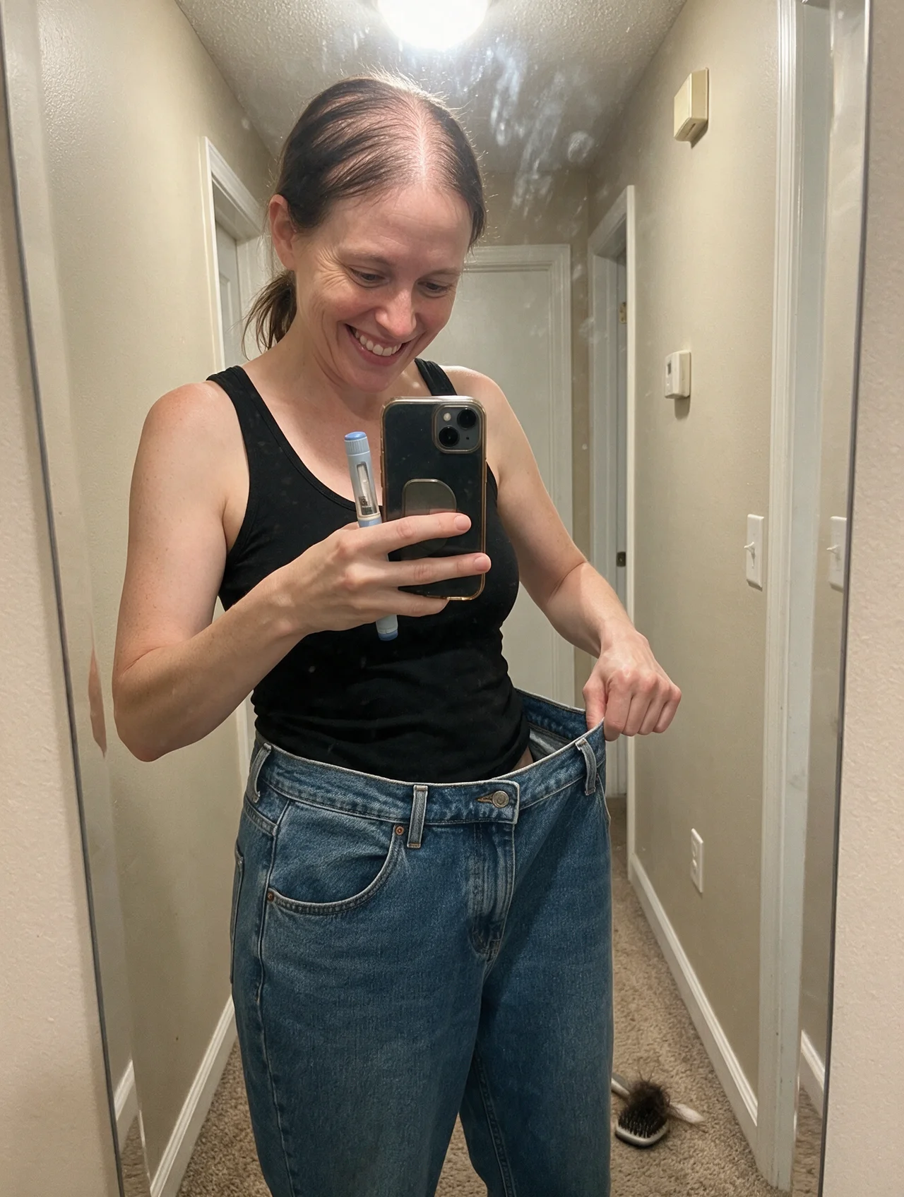 Susan Smith Facebook ad: GLP-1 hair loss is real
