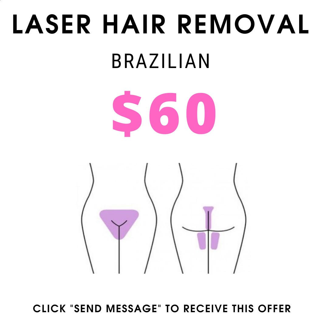 Diamond laserspa Facebook ad: Laser Hair Removal in Brooklyn, smooth skin without…