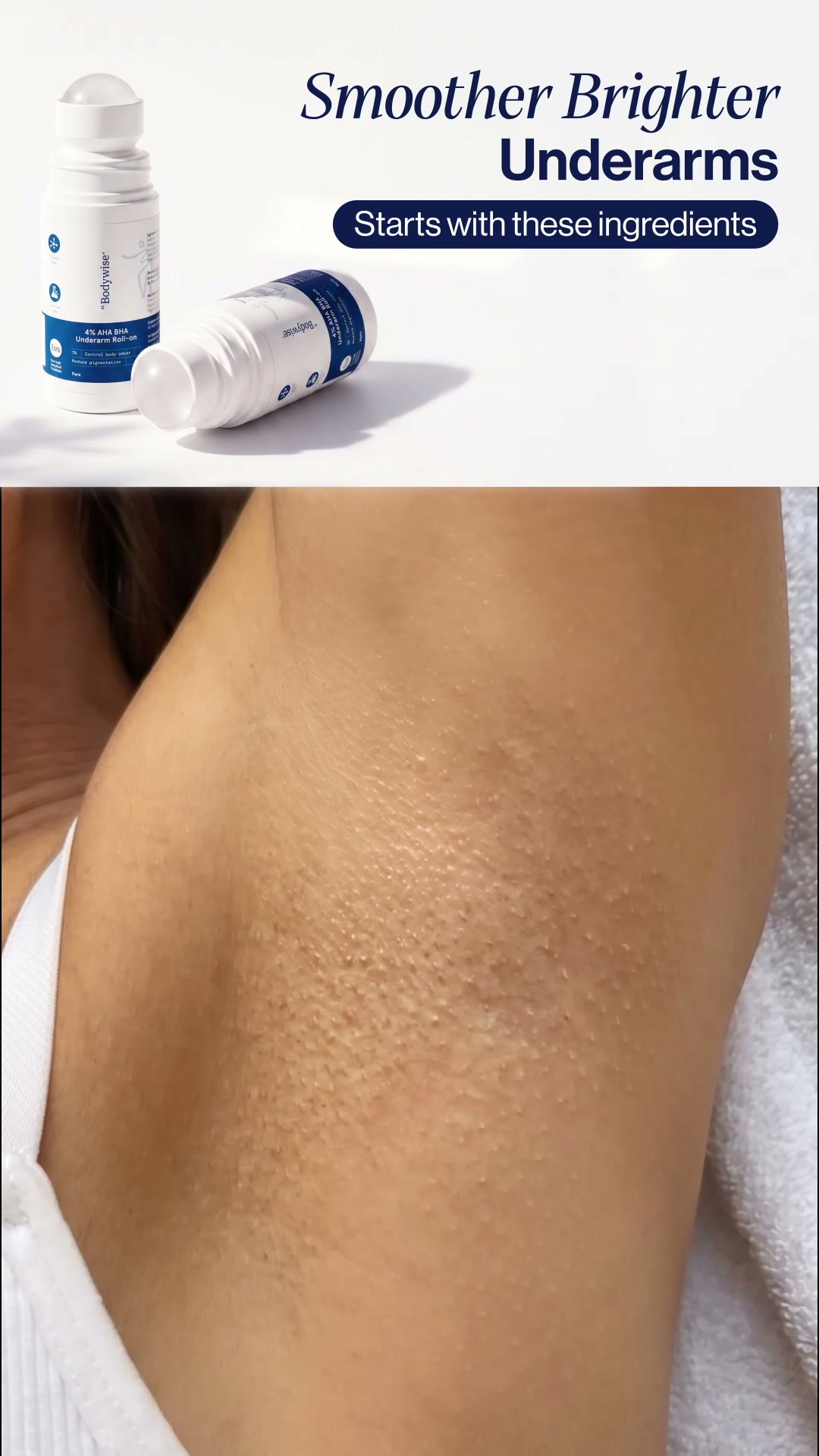 Be Bodywise - UAE Facebook ad: Do you have severe underarm pigmentation?