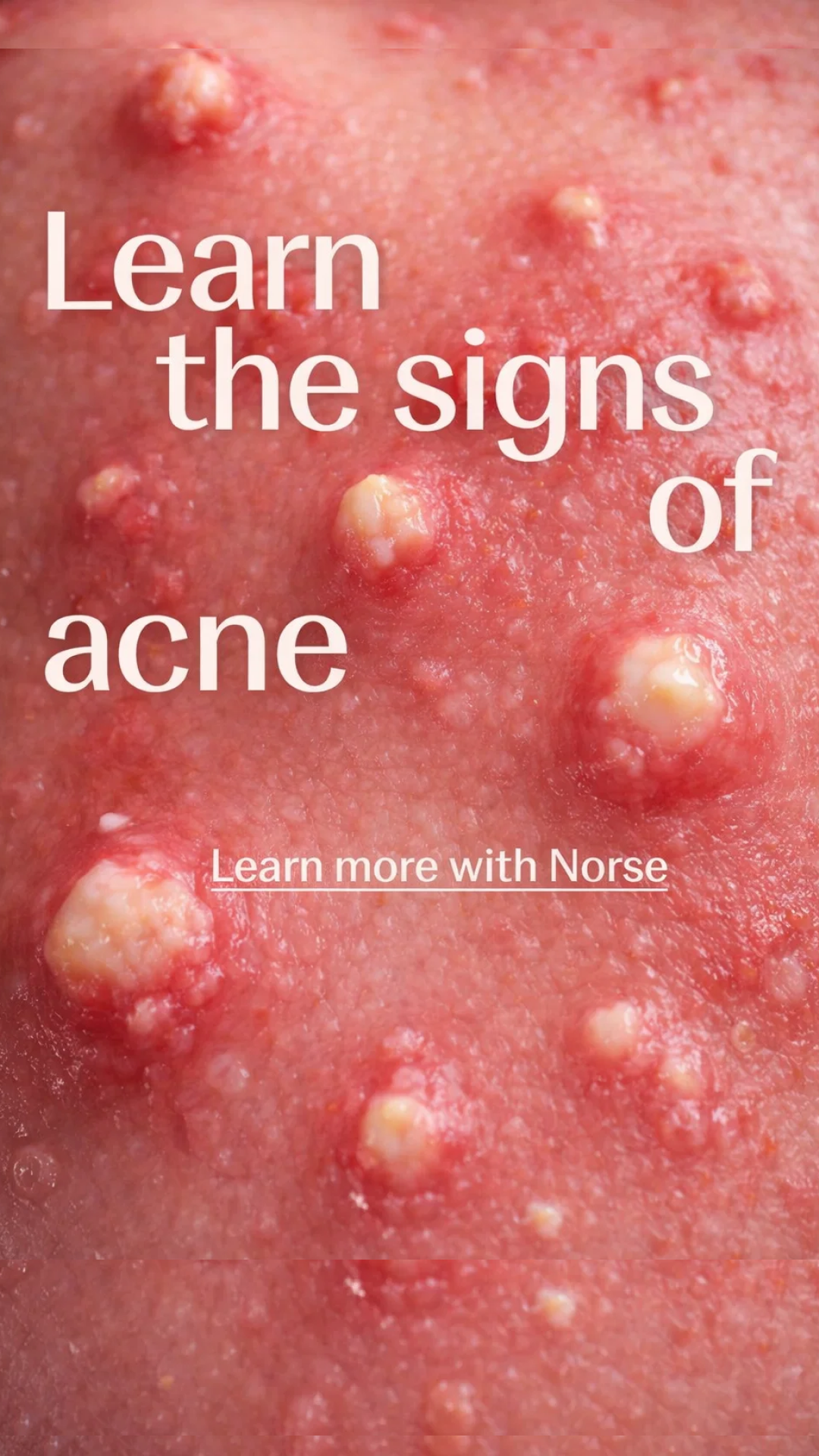 Norse Organics Facebook ad