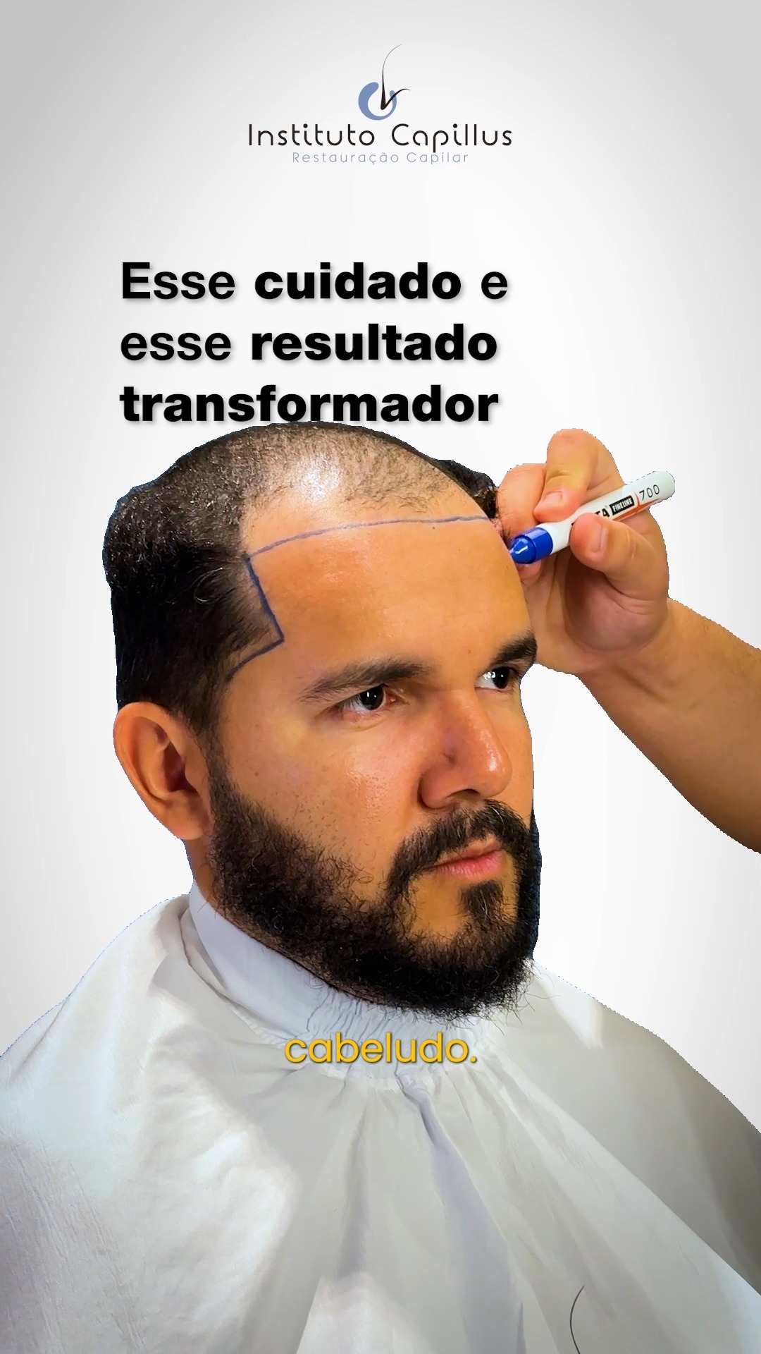 Instituto Capillus Facebook ad: Perda de cabelo não é só estética.