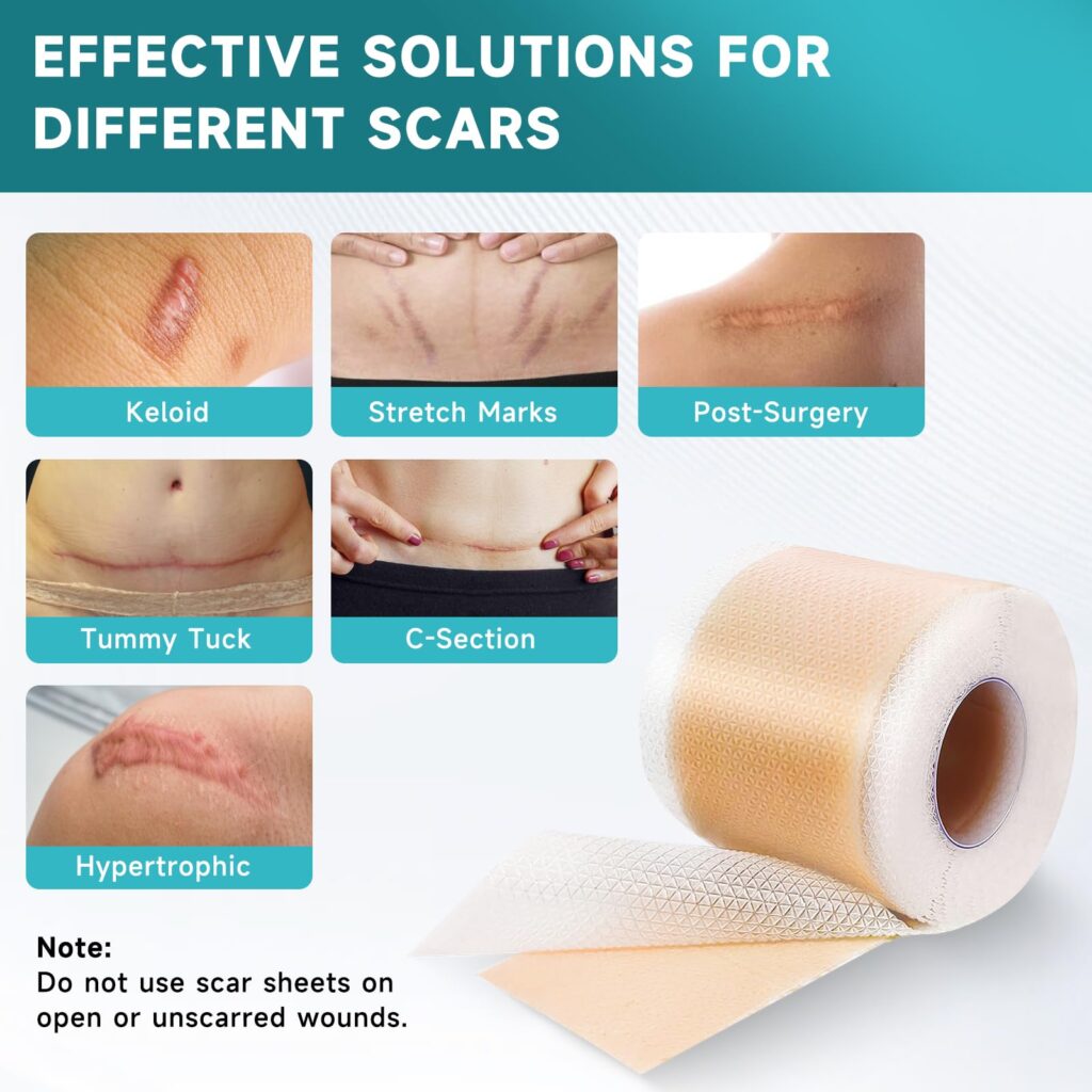 Herbal Action Remedy Facebook ad: Fade old & new scars ASAP