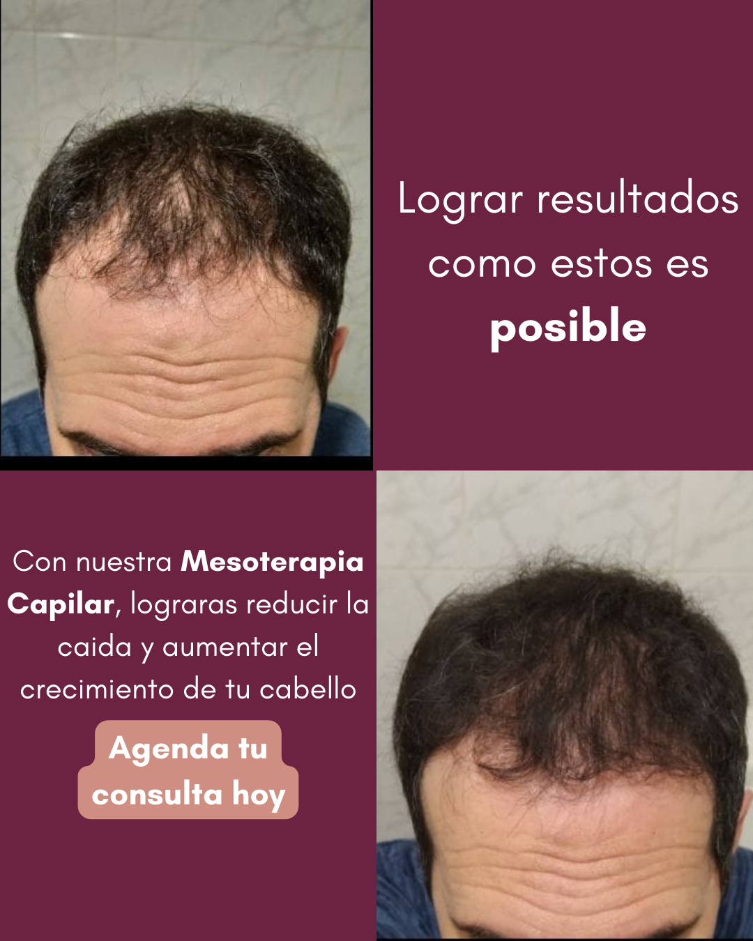 MedEstética Facebook ad
