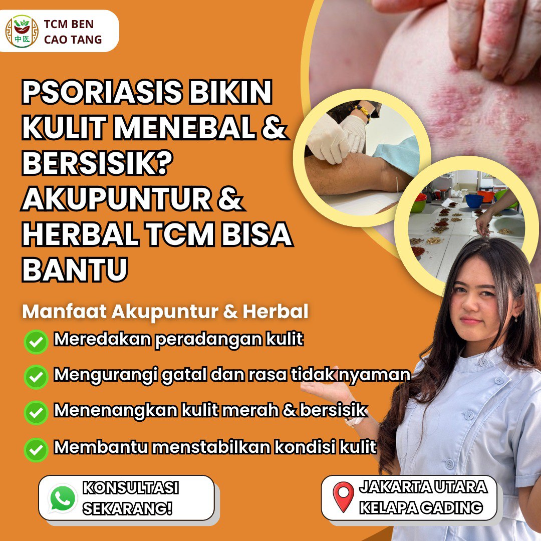 Ben Cao Tang - Griya Sehat & Herbal TCM Facebook ad: Solusi Alami Psoriasis